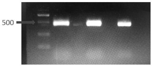 HIV drug resistance detection carrier and construction method