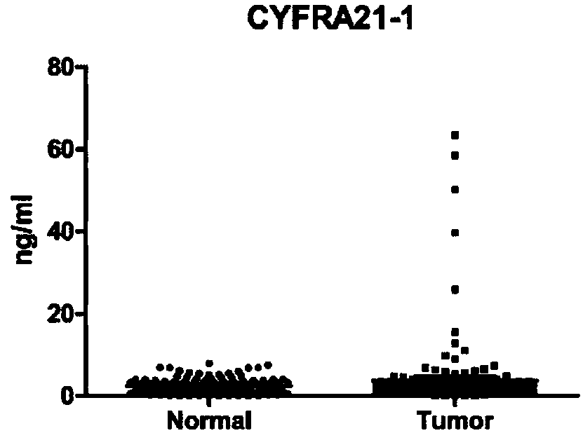 Application of serum protein marker composition in screening and diagnosis and treatment of lung cancer