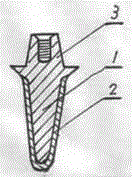 Medical dental implant with surface biomimetic function and manufacturing method thereof