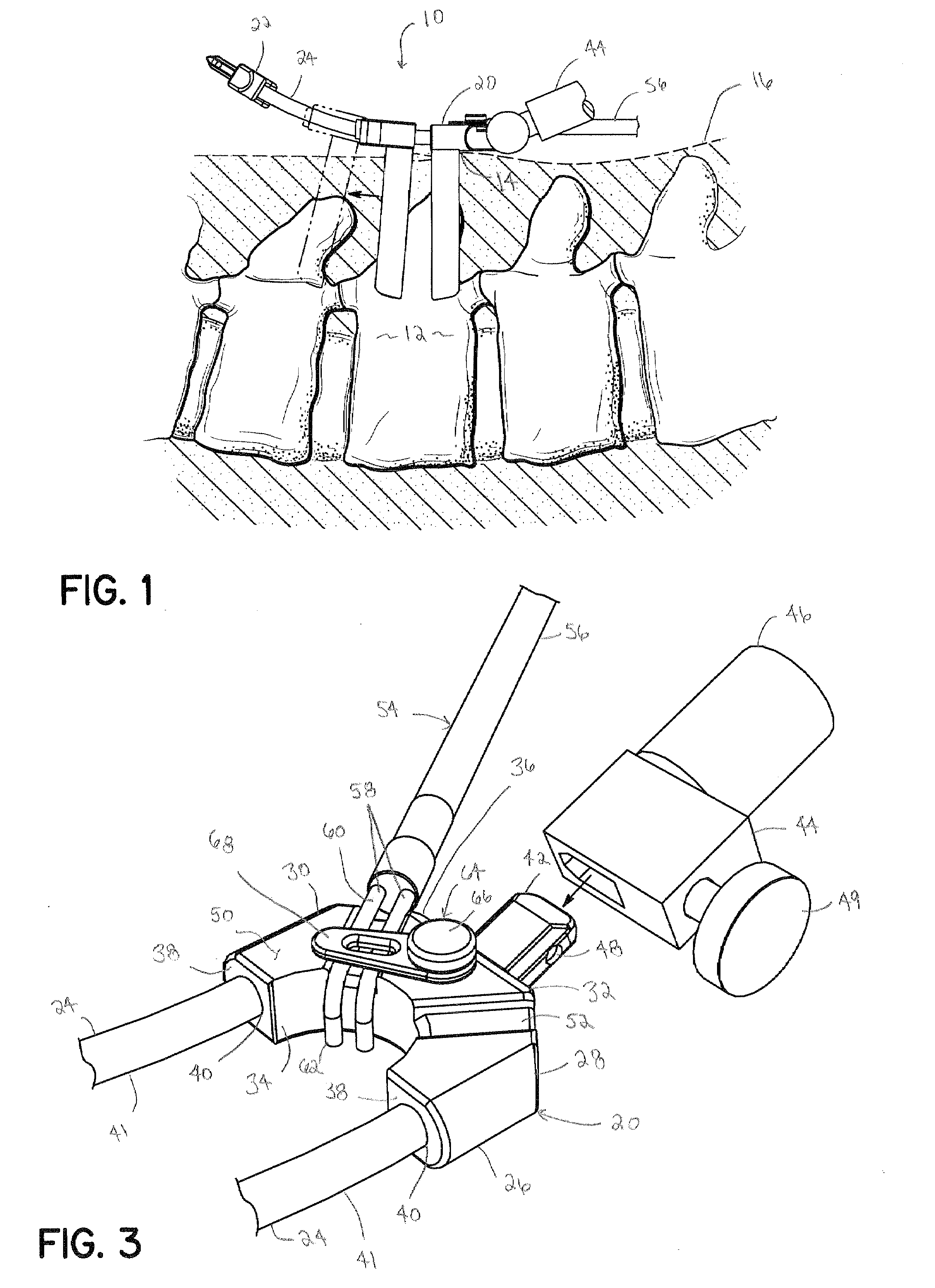 Surgical access system and method of using the same