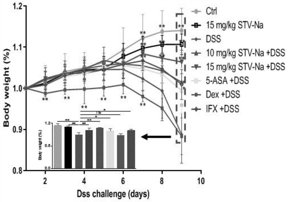 Application of kaurane compound in preparation of medicine for preventing and treating inflammatory bowel disease