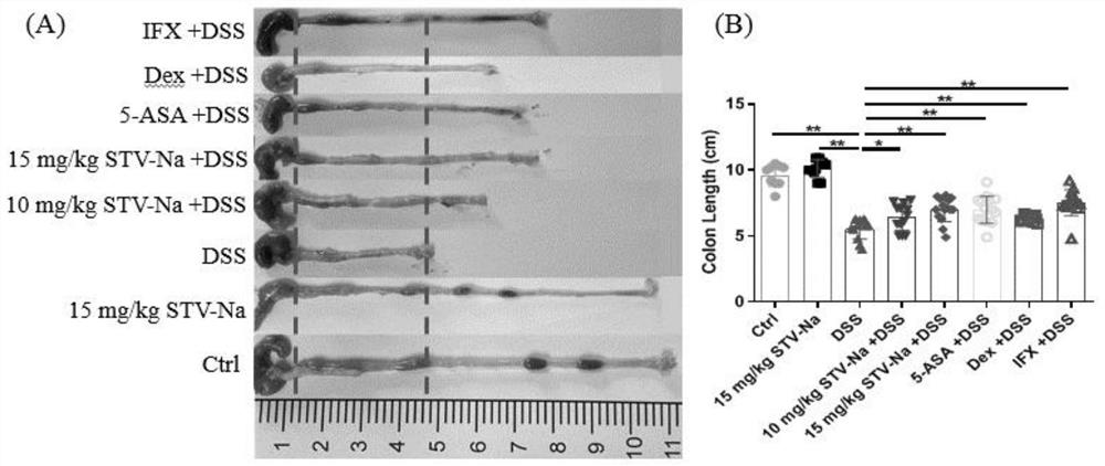 Application of kaurane compound in preparation of medicine for preventing and treating inflammatory bowel disease