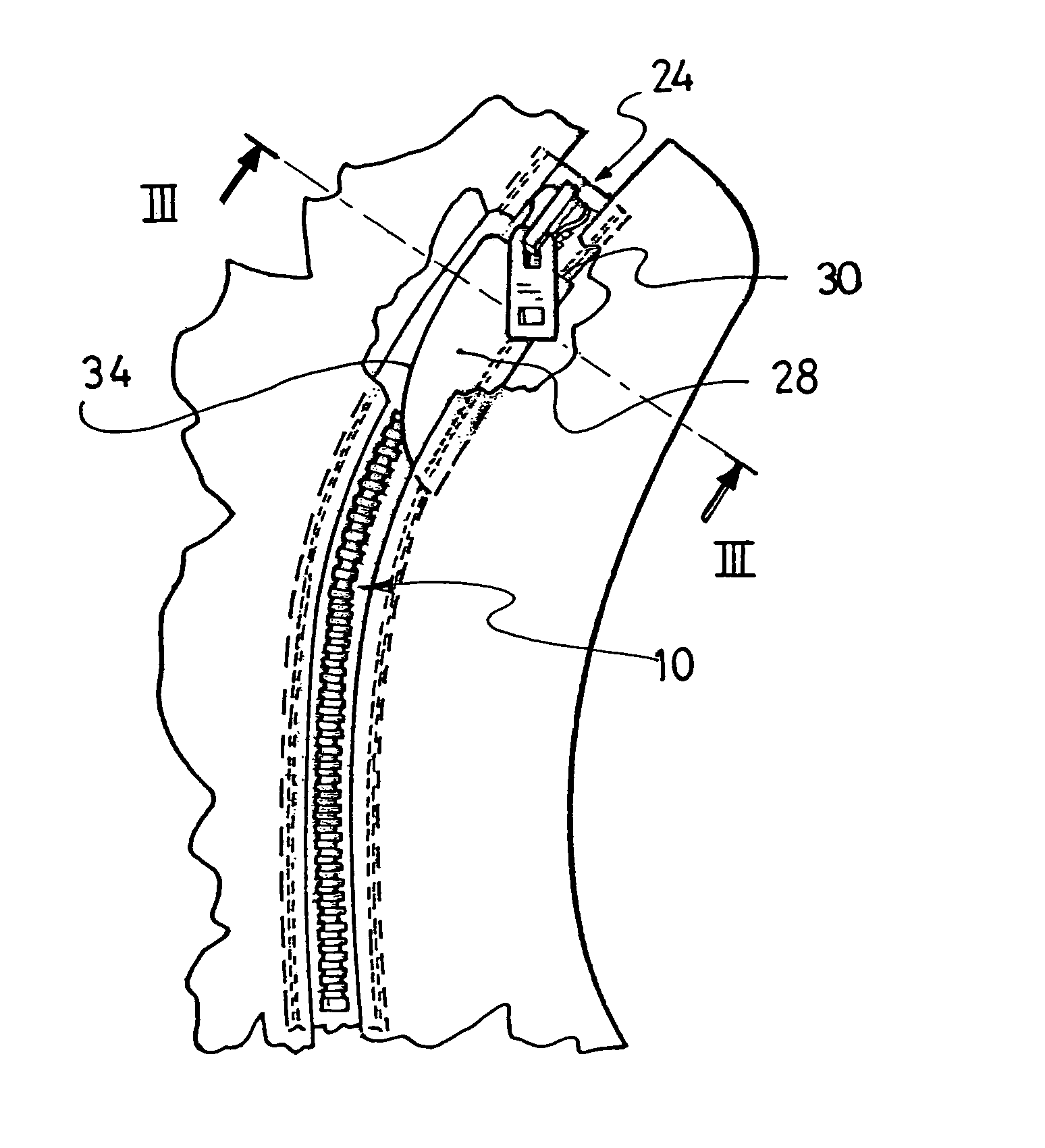 Slide fastener with blocking of the slider