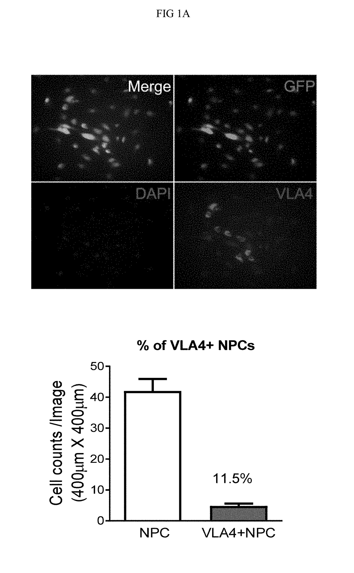 Compositions and methods for treatment of gcase related disease states