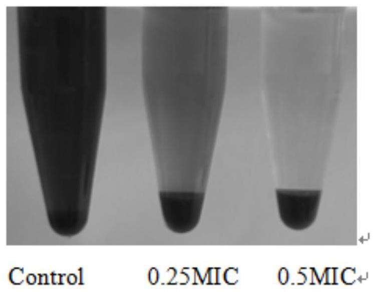 Ruthenium polypyridine complex with triethylamine structure as well as preparation method and application of ruthenium polypyridine complex