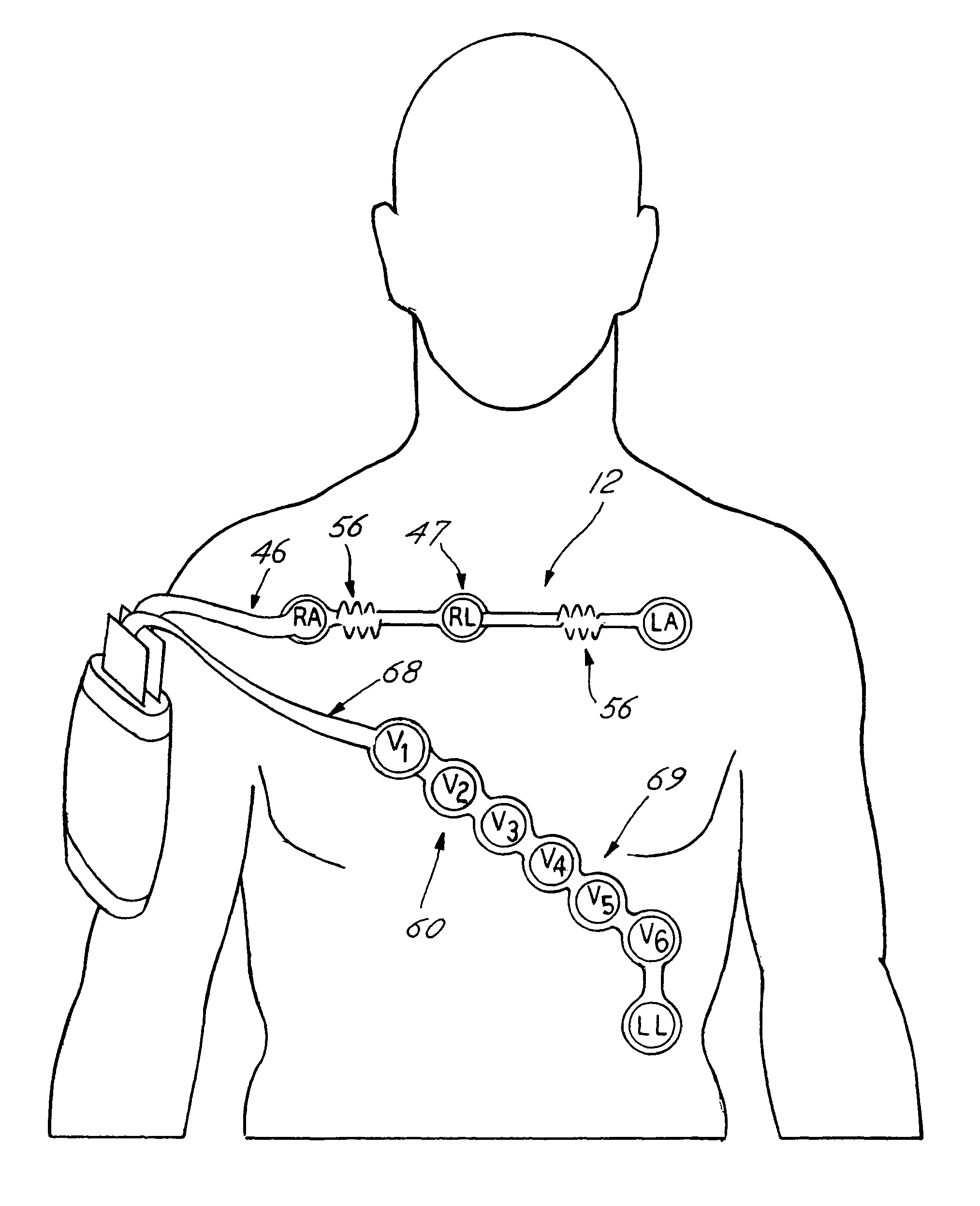 Radiolucent chest assembly