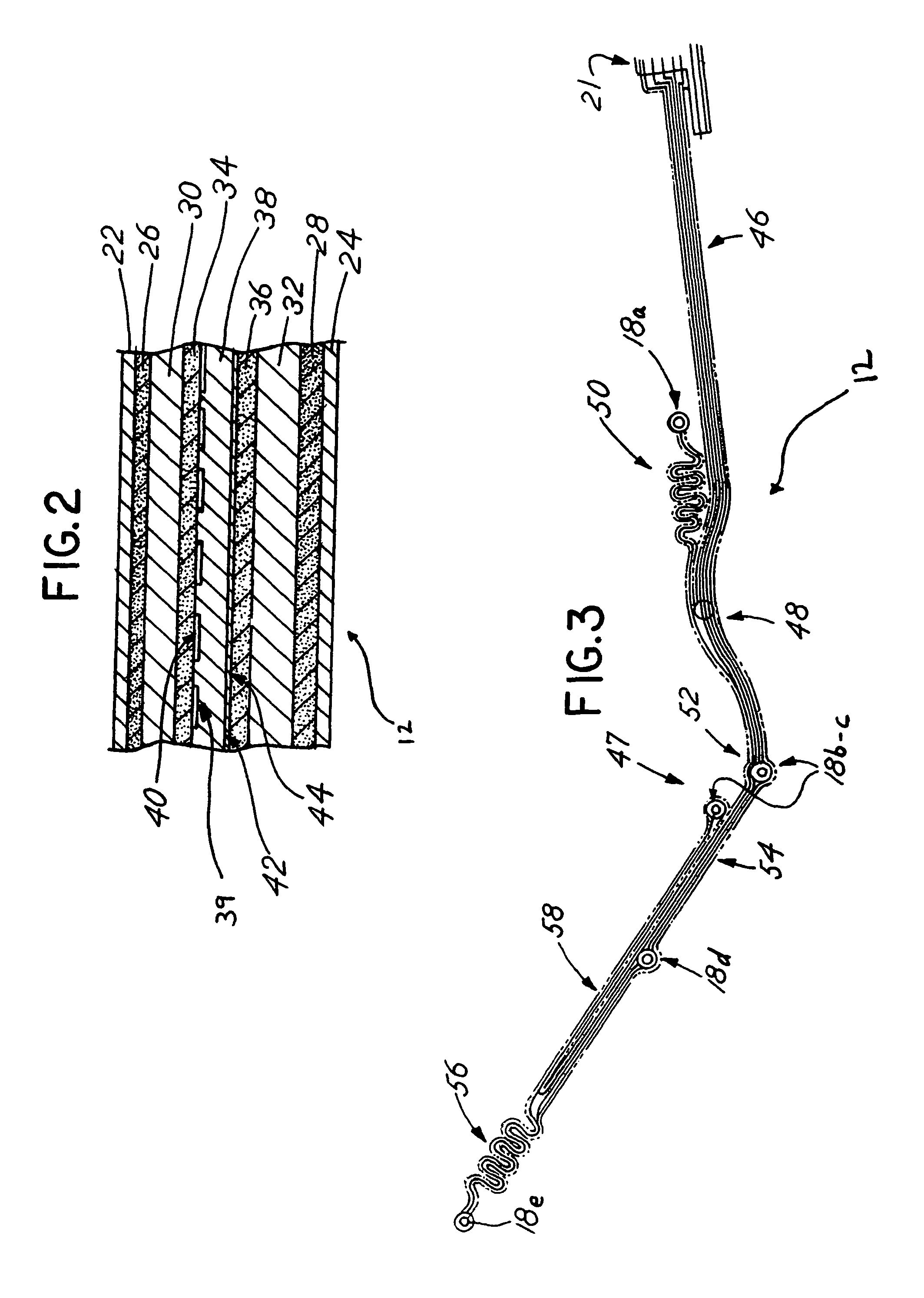 Radiolucent chest assembly