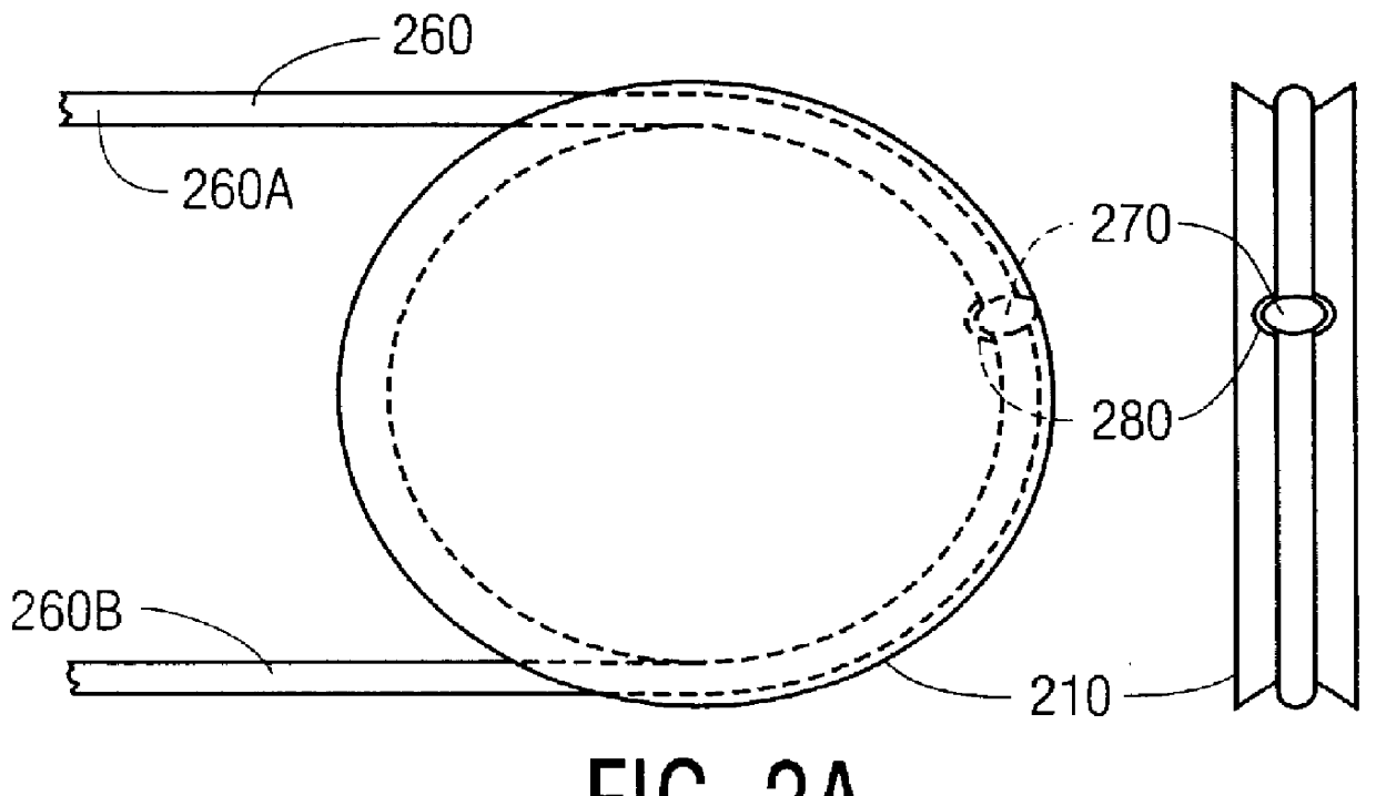 Positioning system for an observation device using a tensioned filament and locator ball