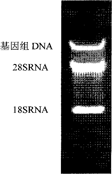 Method for purifying total nucleic acid by using gold-magnetic particles