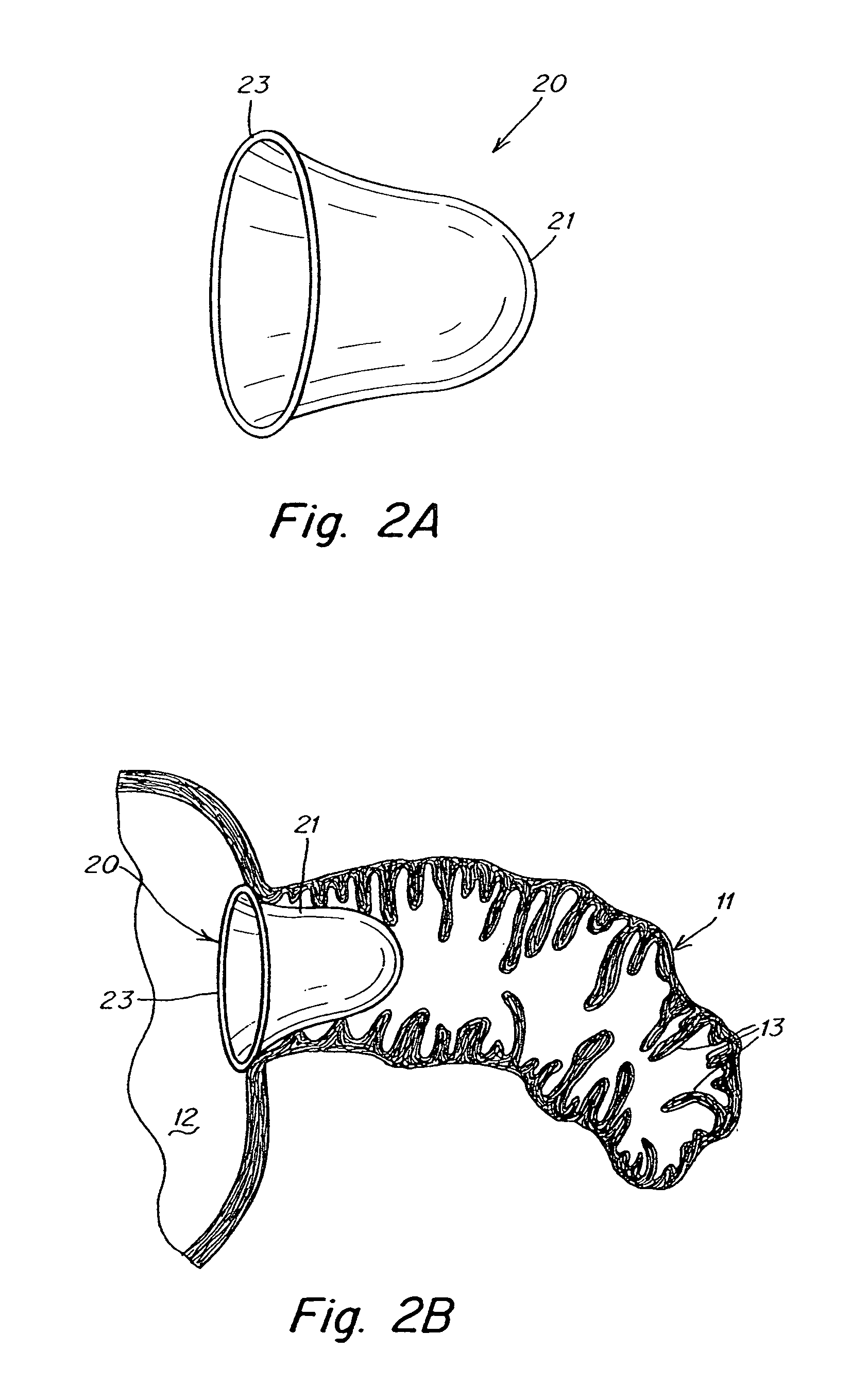 Device and methods for preventing formation of thrombi in the left atrial appendage