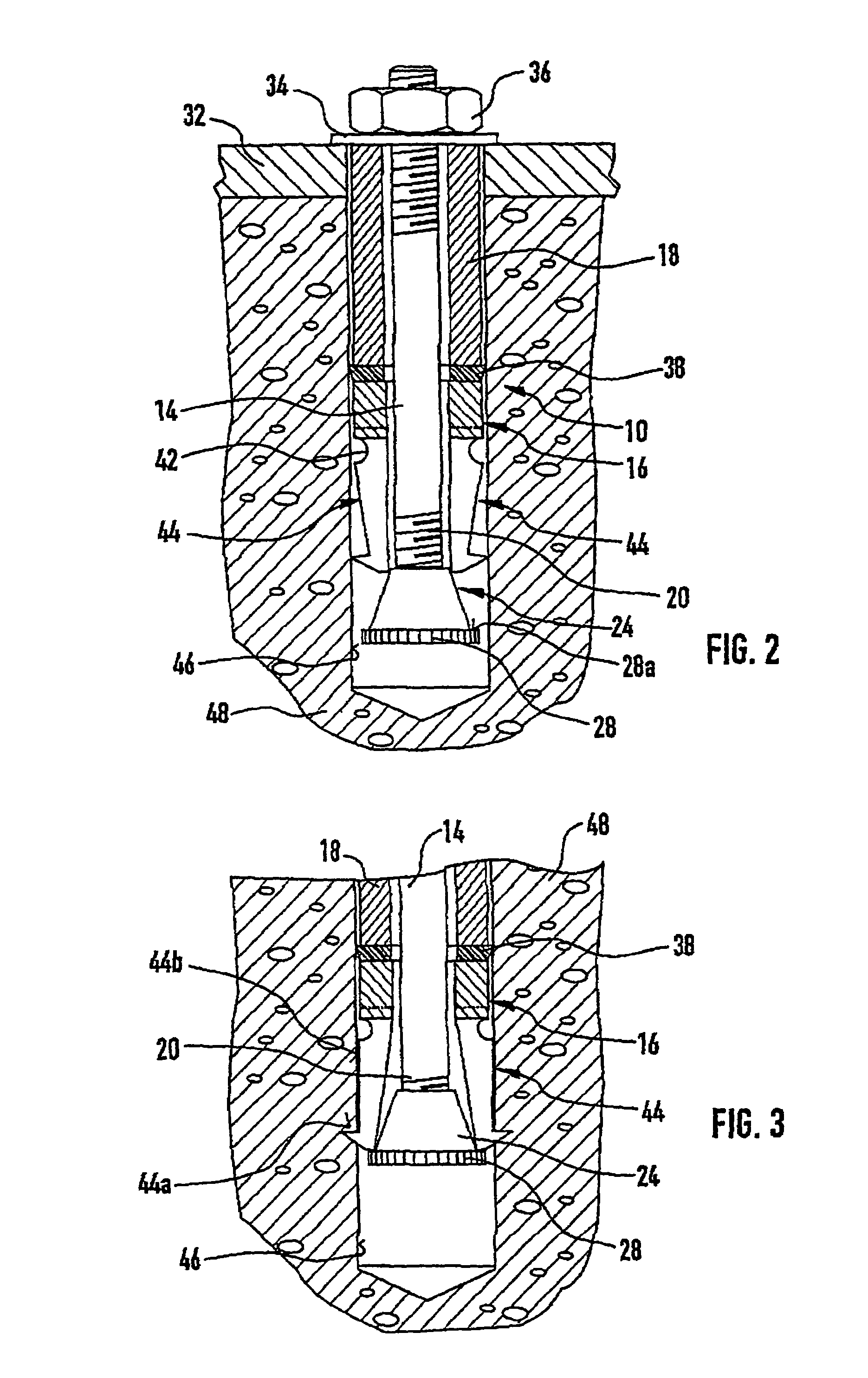 Undercut anchor element that can be mounted with positive engagement