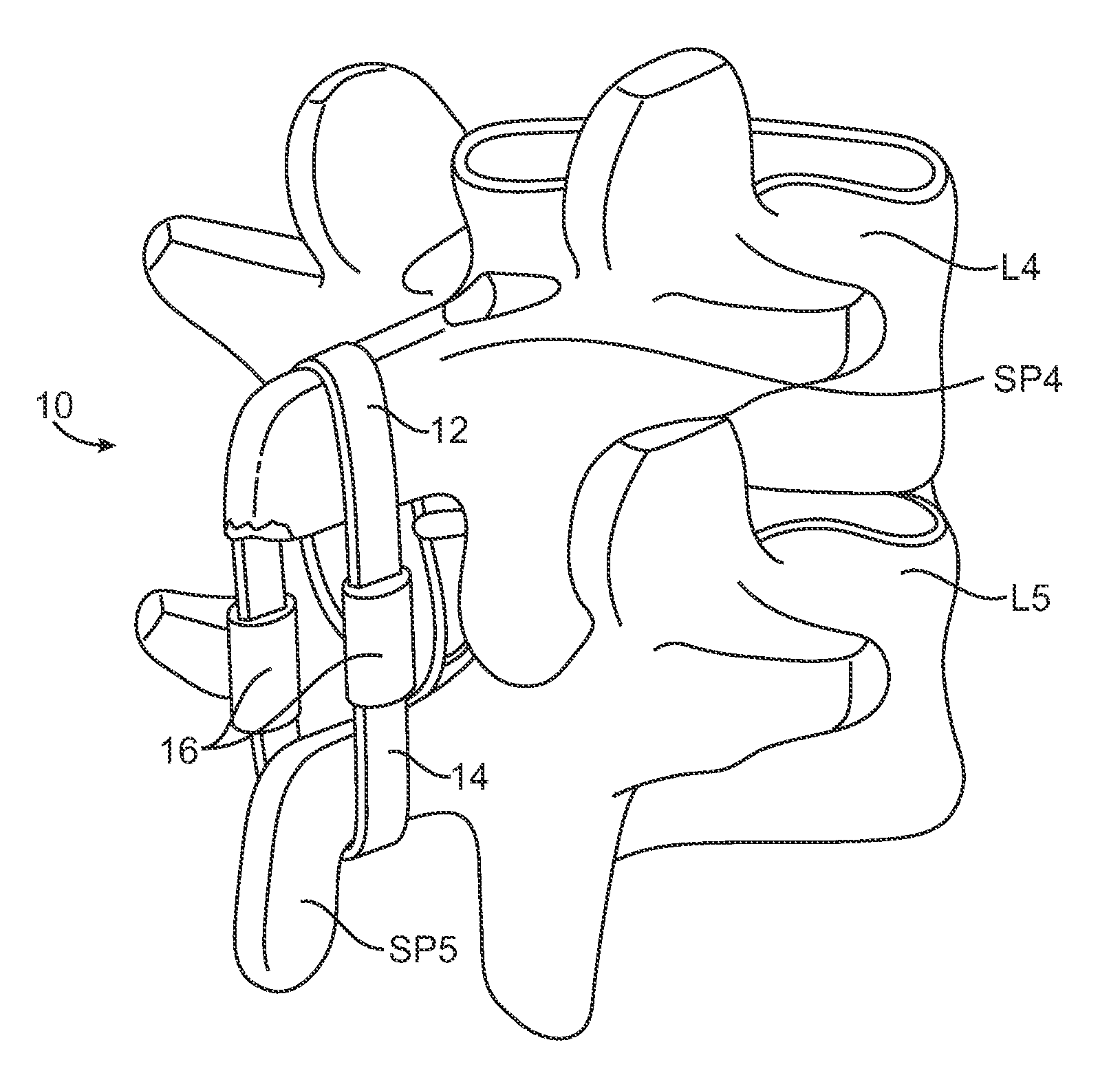 Methods and apparatus for locking a band