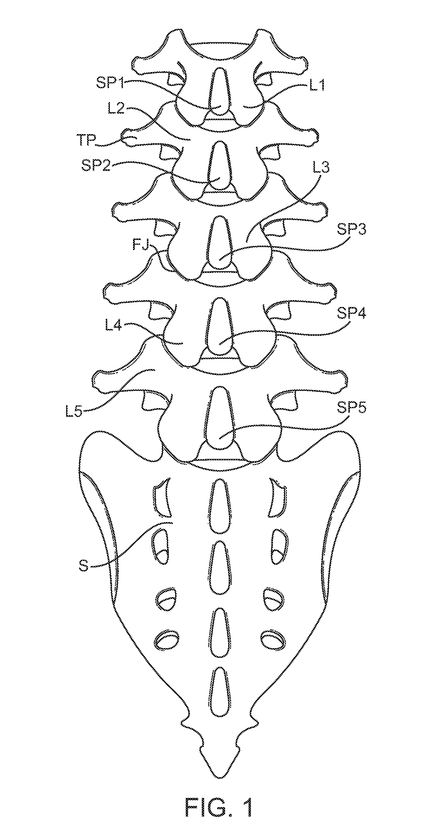 Methods and apparatus for locking a band