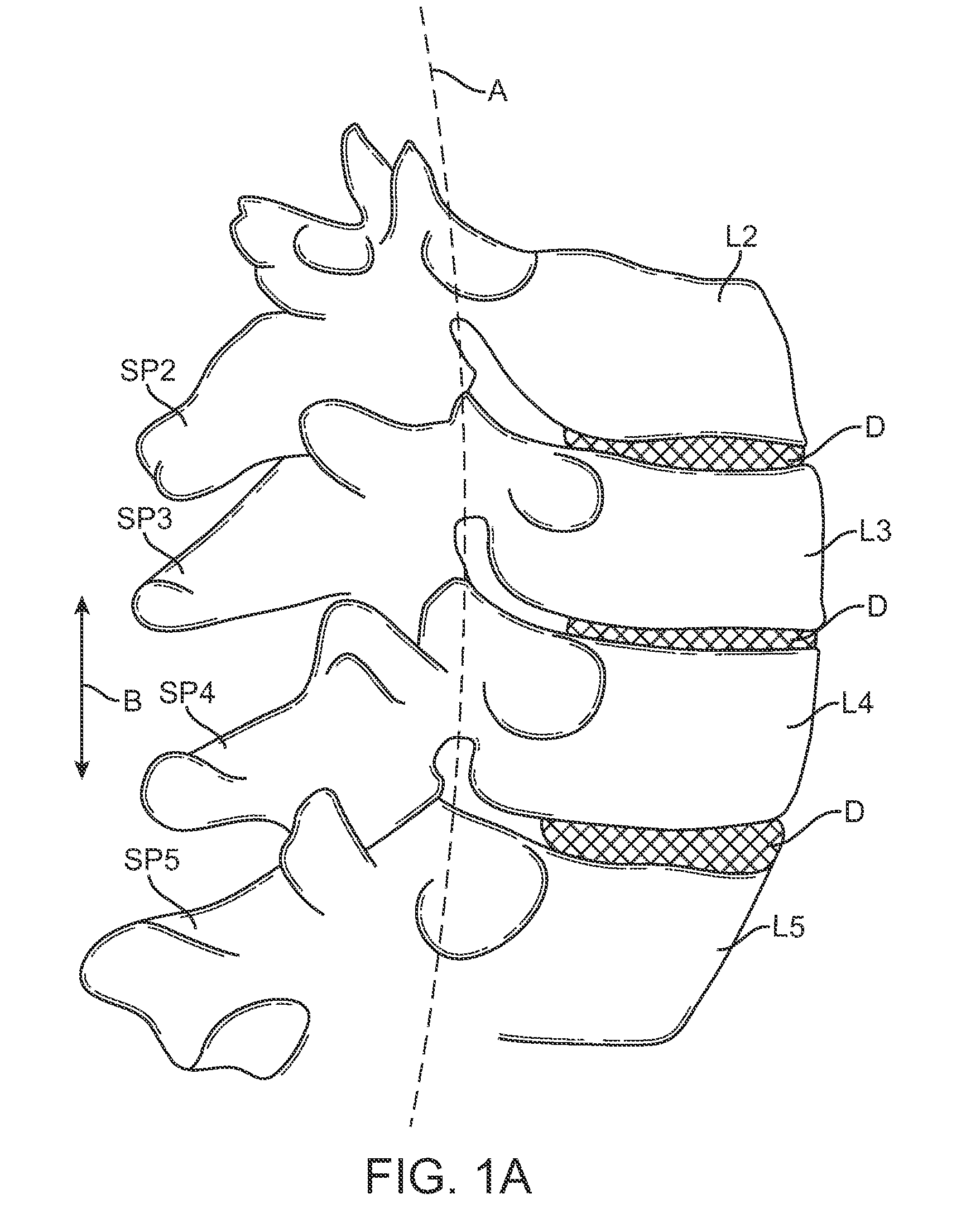 Methods and apparatus for locking a band