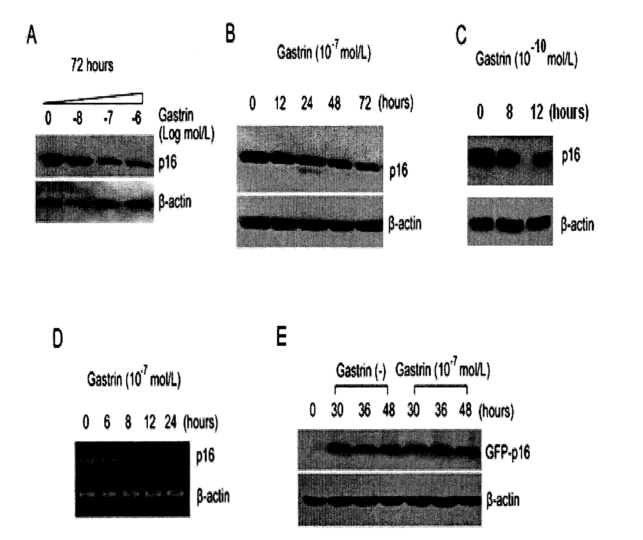 Application of gastrin in inhibiting gastrointestinal tumor cells