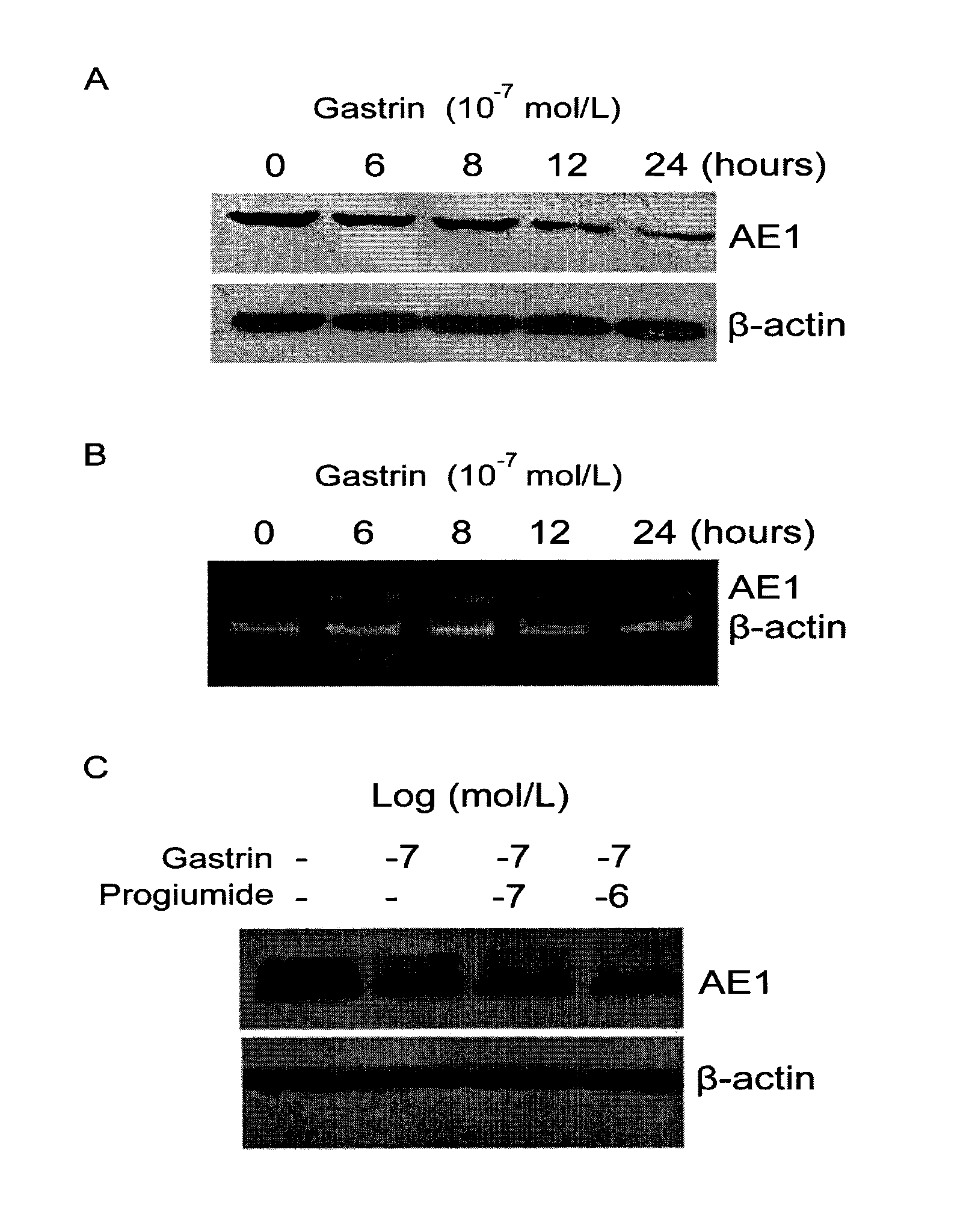 Application of gastrin in inhibiting gastrointestinal tumor cells