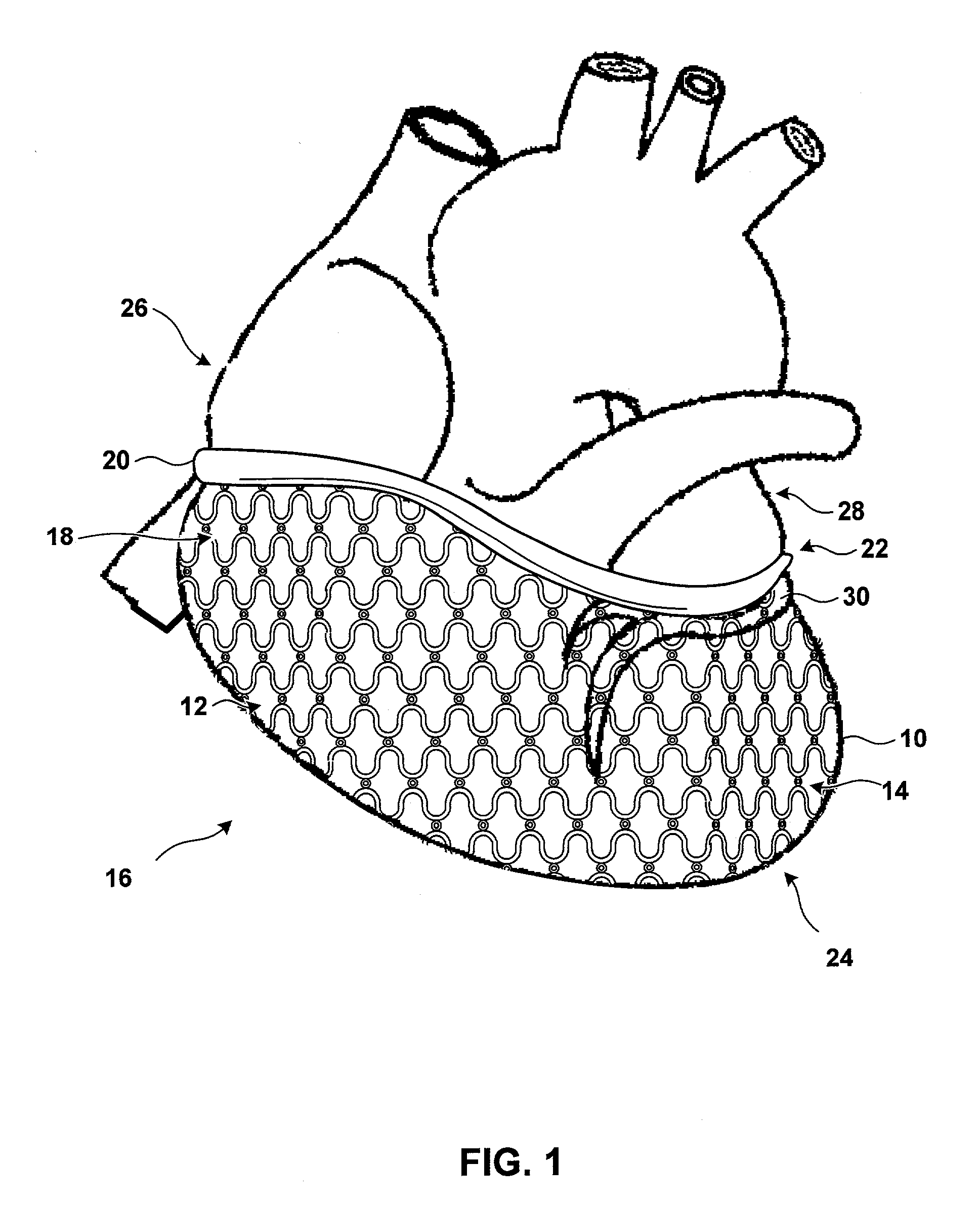 Cardiac restraint with electrode attachment sites