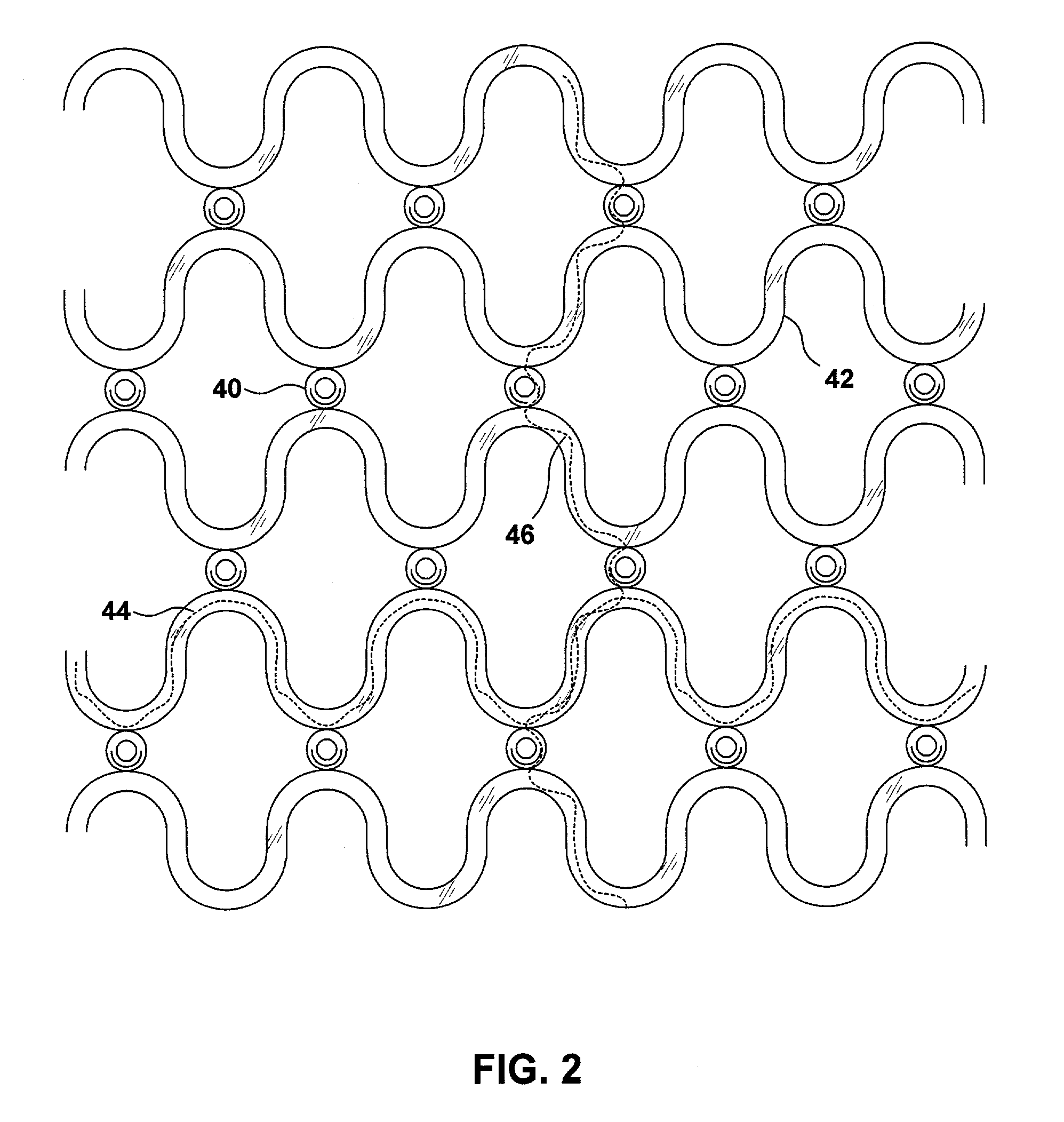 Cardiac restraint with electrode attachment sites