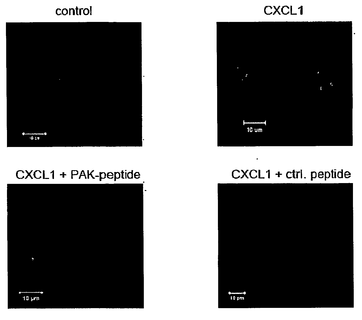 Compositions and Methods for Inhibiting Leukocyte Function