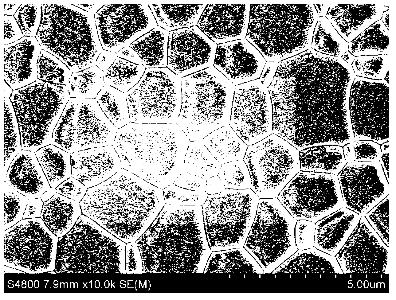 Orthodontic highly-transparent ceramic bracket and making method thereof