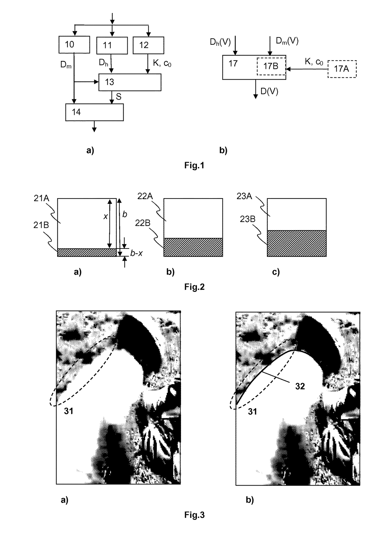 Method and device for calculating distortion of a video being affected by compression artifacts and channel artifacts