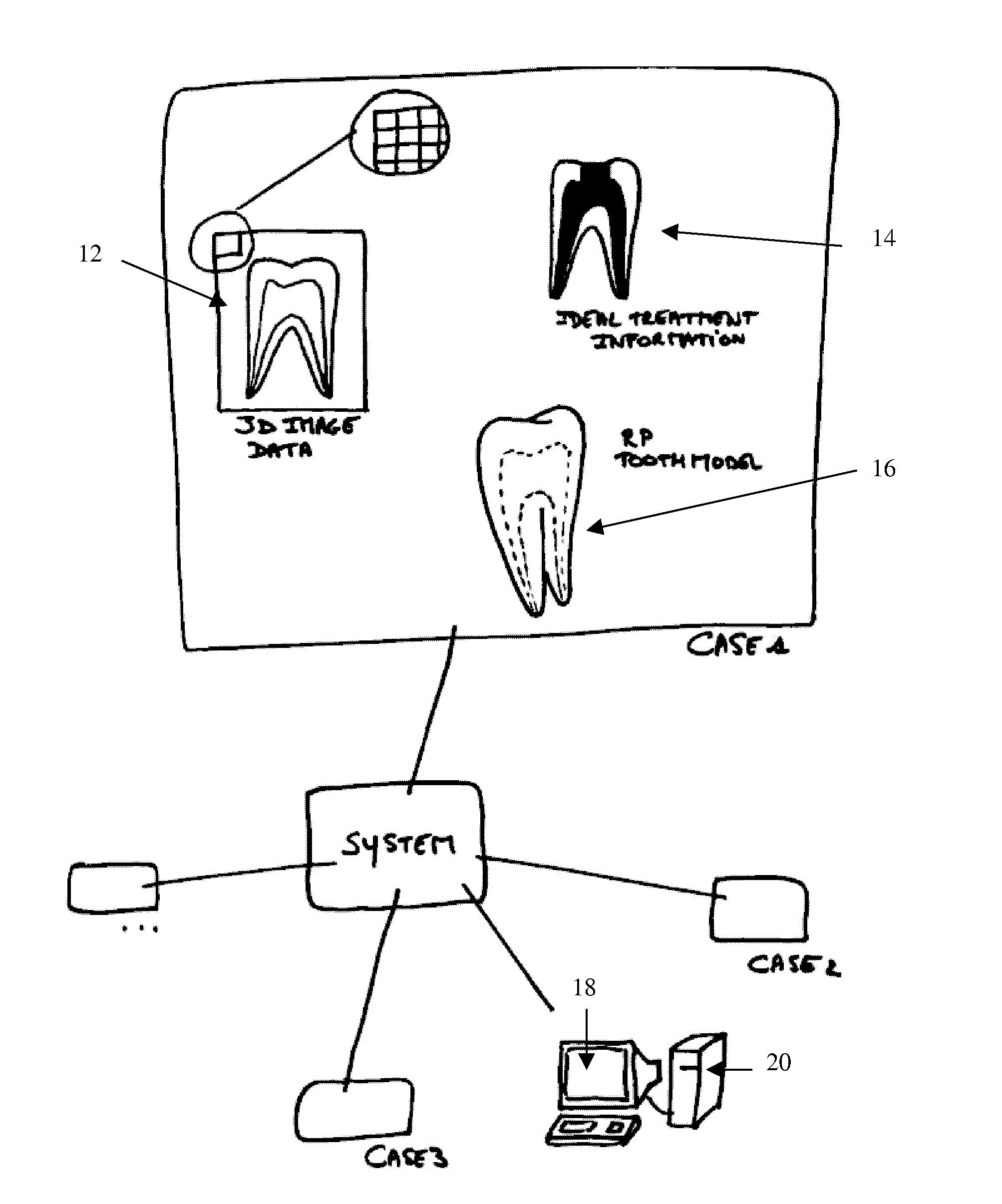 Endodontic treatment simulation system