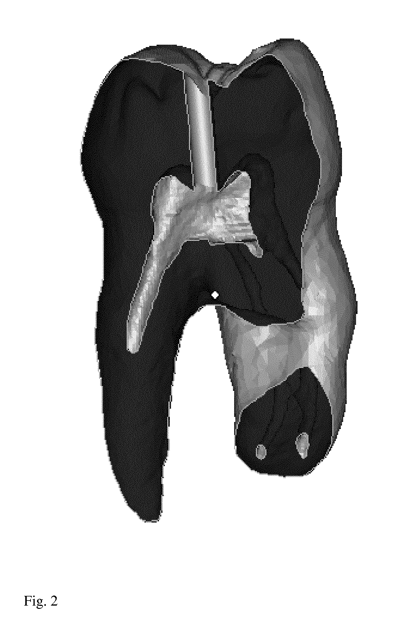 Endodontic treatment simulation system