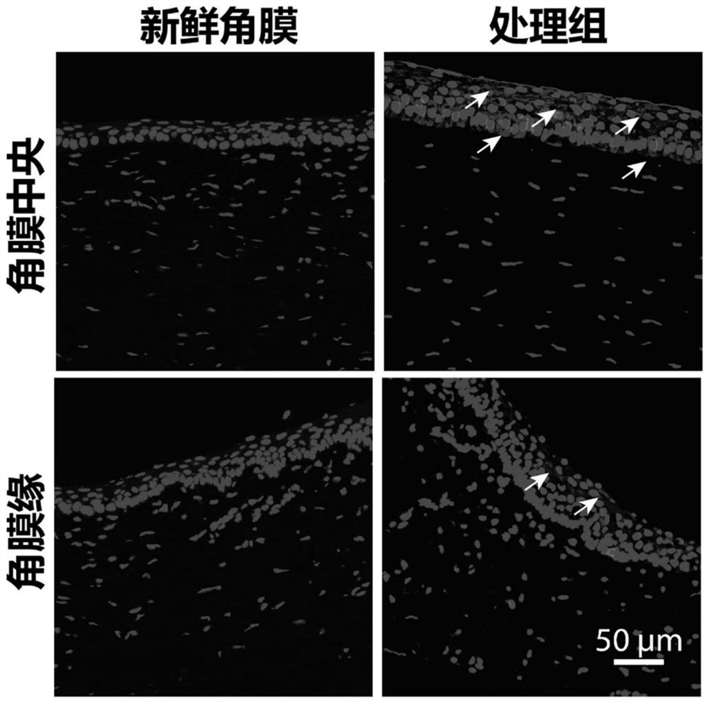 Limbal stem cells and preparation method thereof