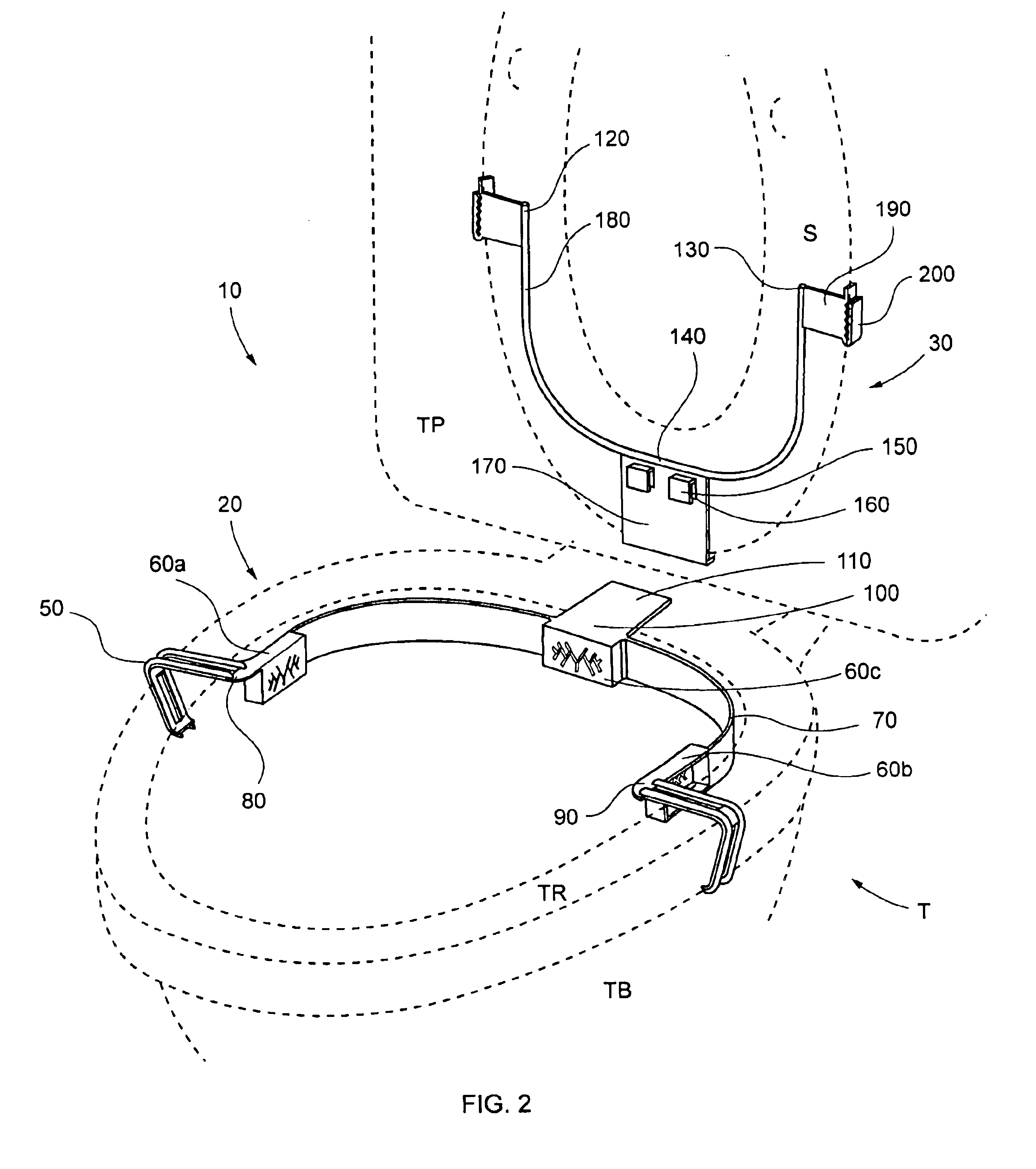 Overspray shield for toilet