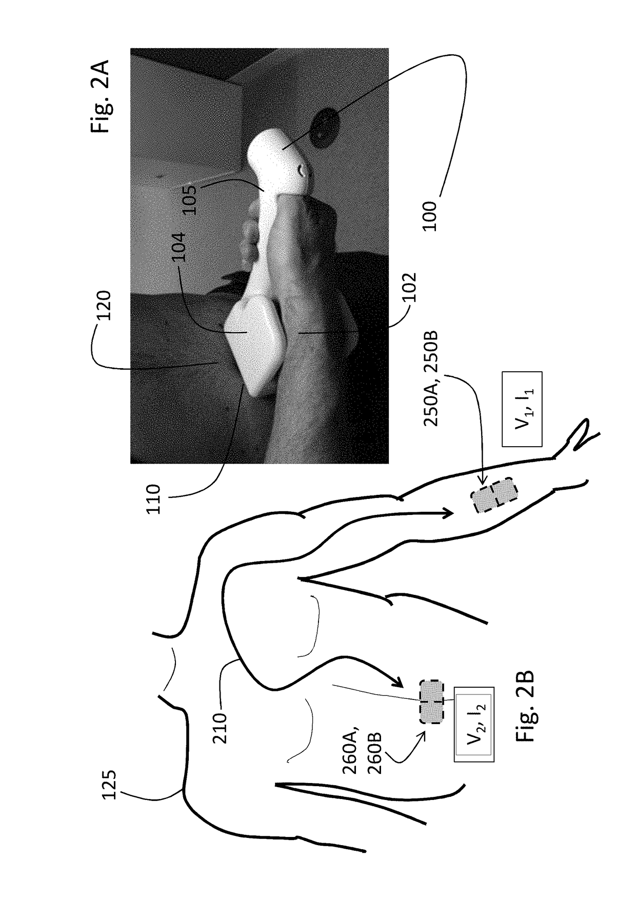 Handheld physiological sensor