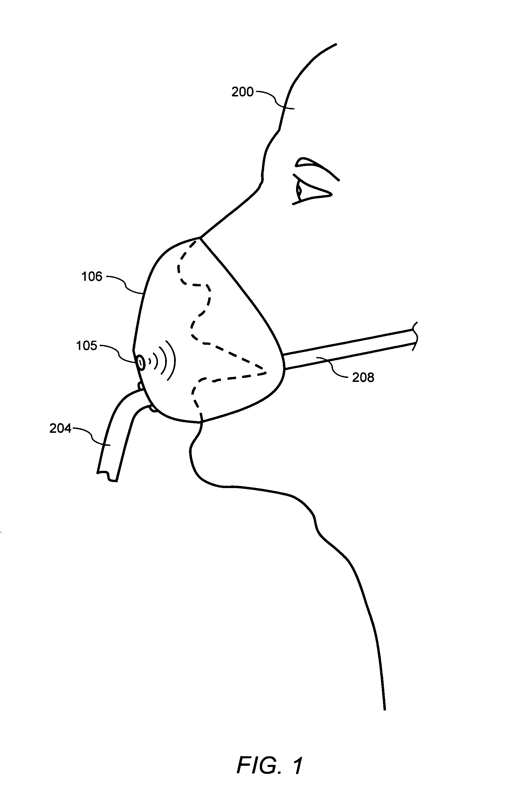 Unique device for determining airway obstructions