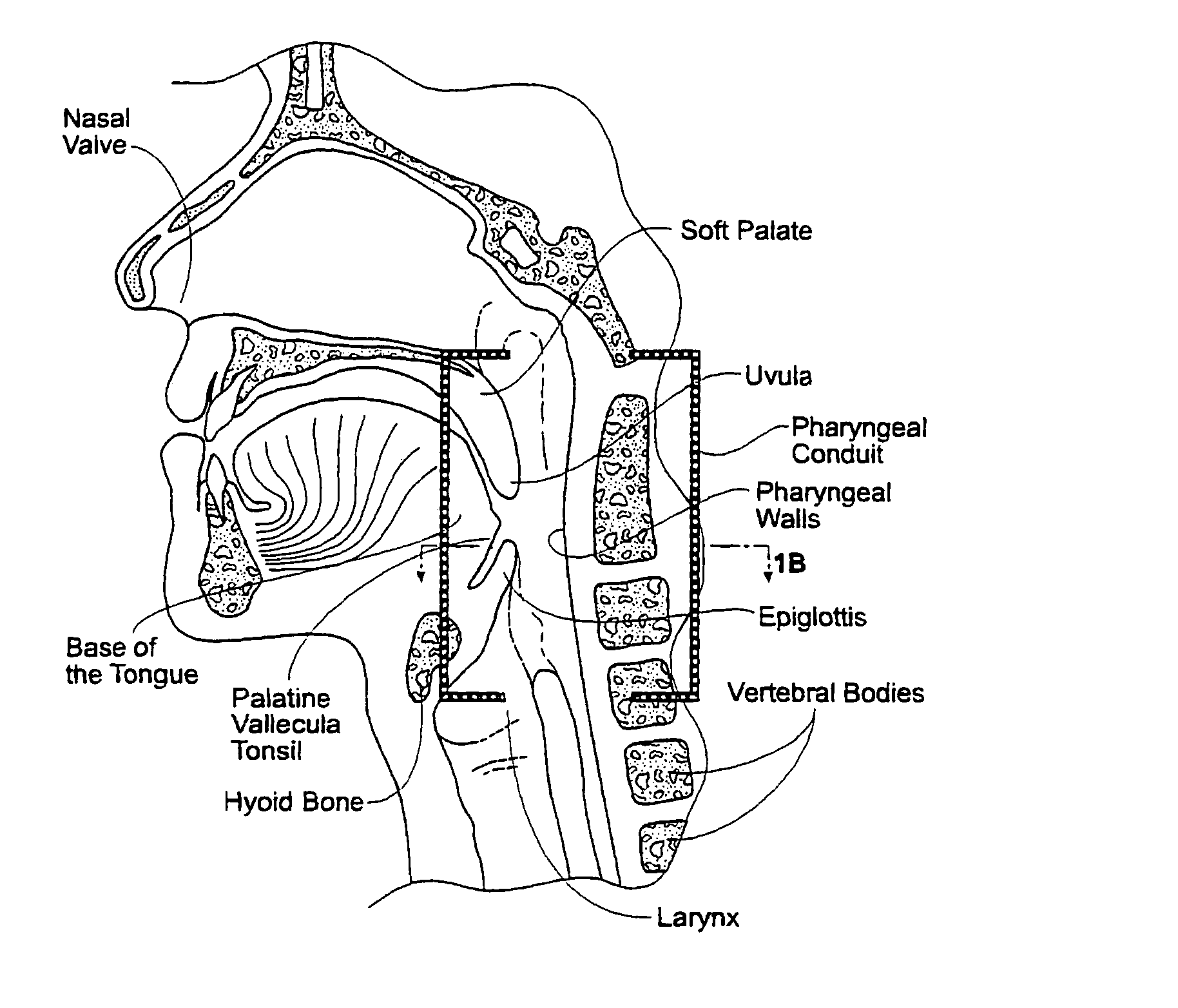 Magnetic force device, systems, and methods for resisting tissue collapse within the pharyngeal conduit