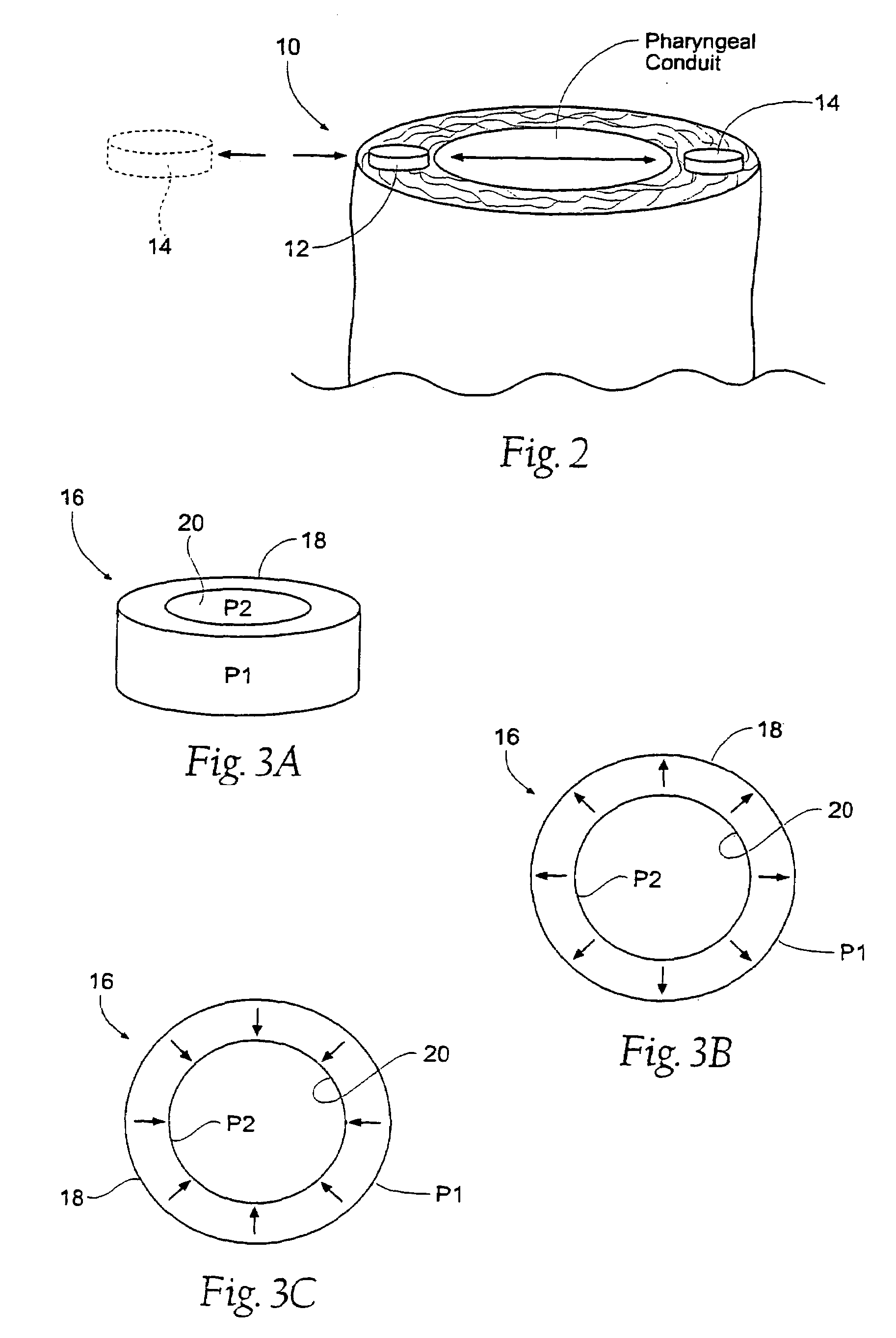 Magnetic force device, systems, and methods for resisting tissue collapse within the pharyngeal conduit