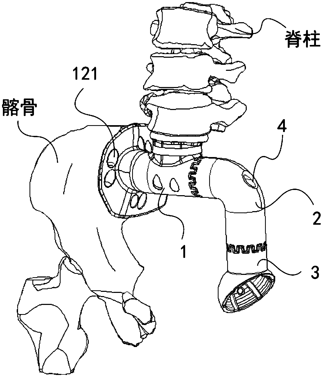 Sacrum and pelvis combined prosthesis