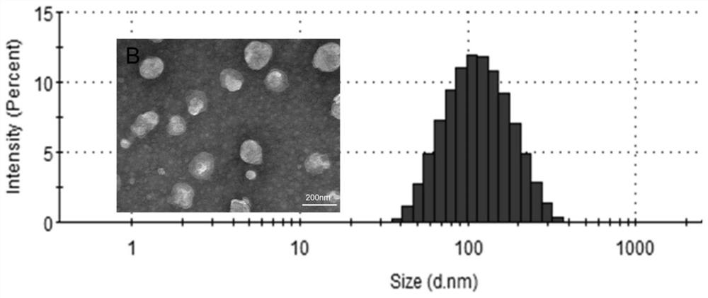 Doxorubicin long-circulating liposome targeted drug and preparation method thereof