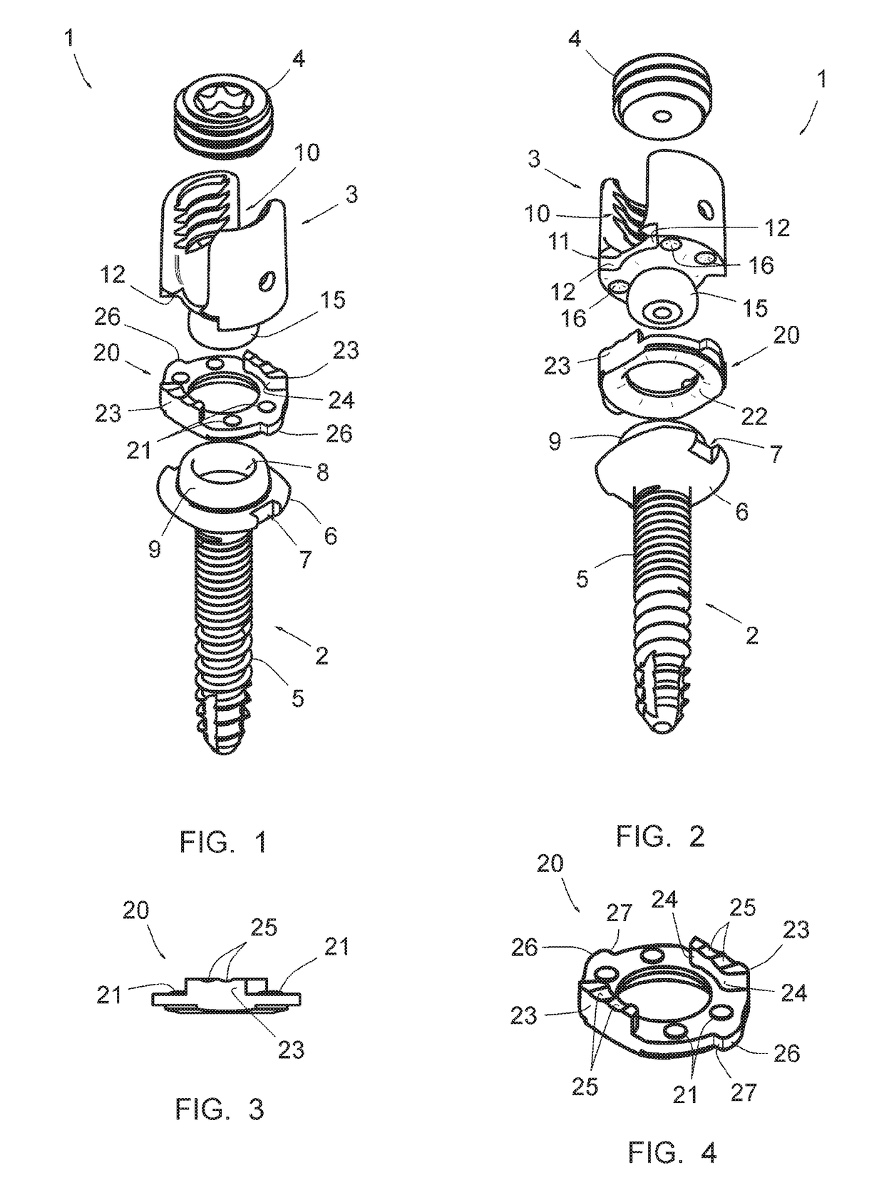 Vertebral osteosynthesis equipment