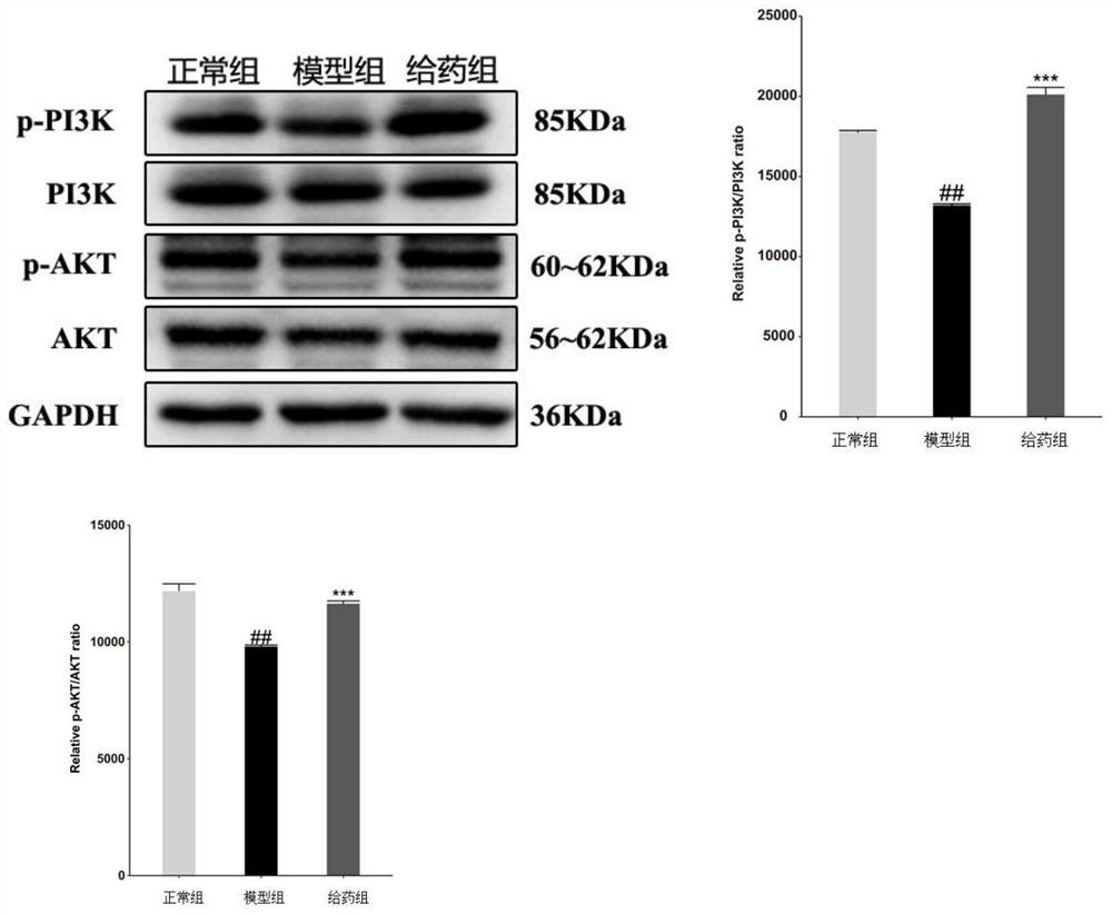 Application of nauclea officinalis extract in preparation of medicine for preventing and treating oral ulcer diseases