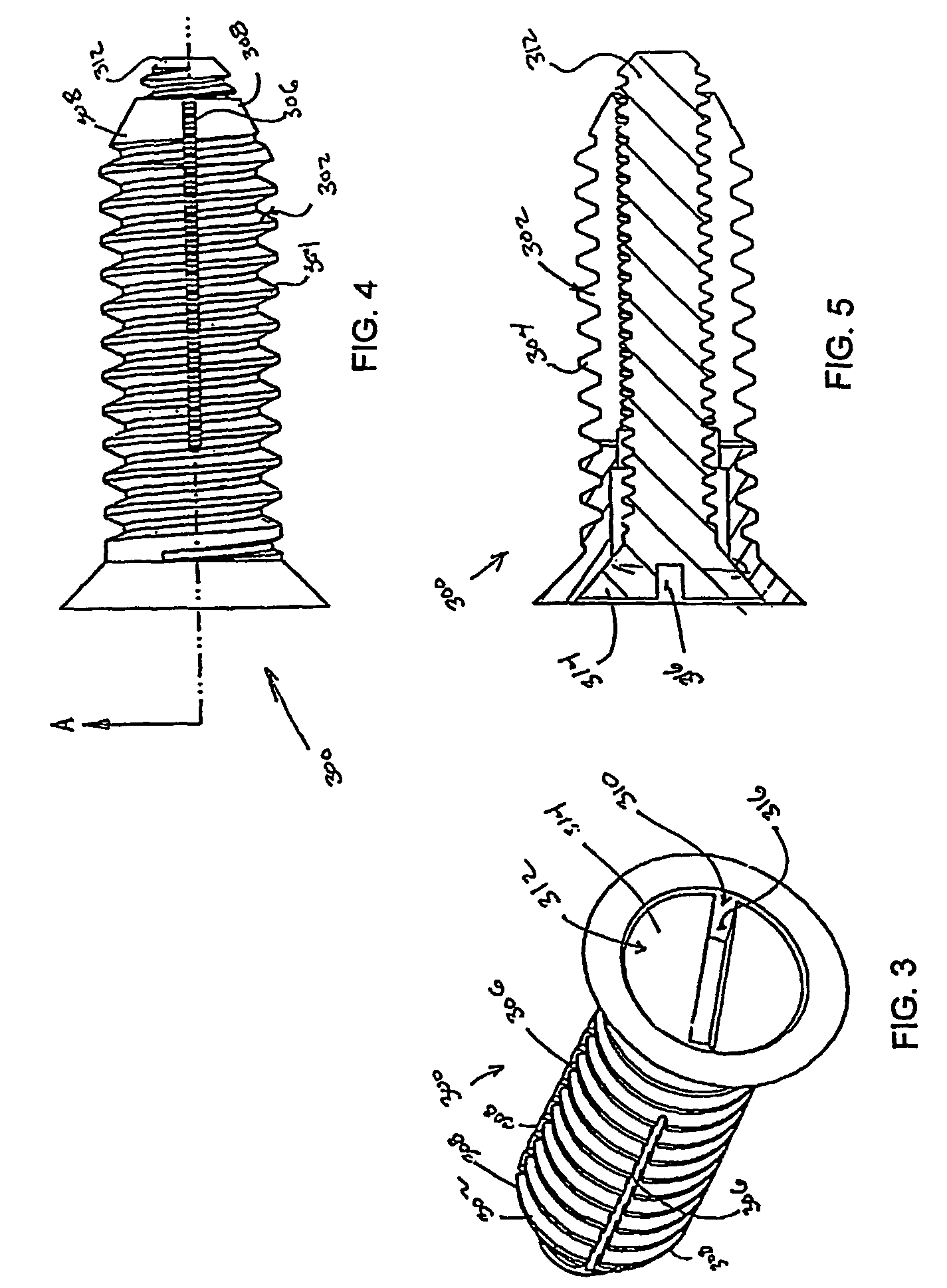 Bone fasteners and method for stabilizing vertebral bone facets using the bone fasteners