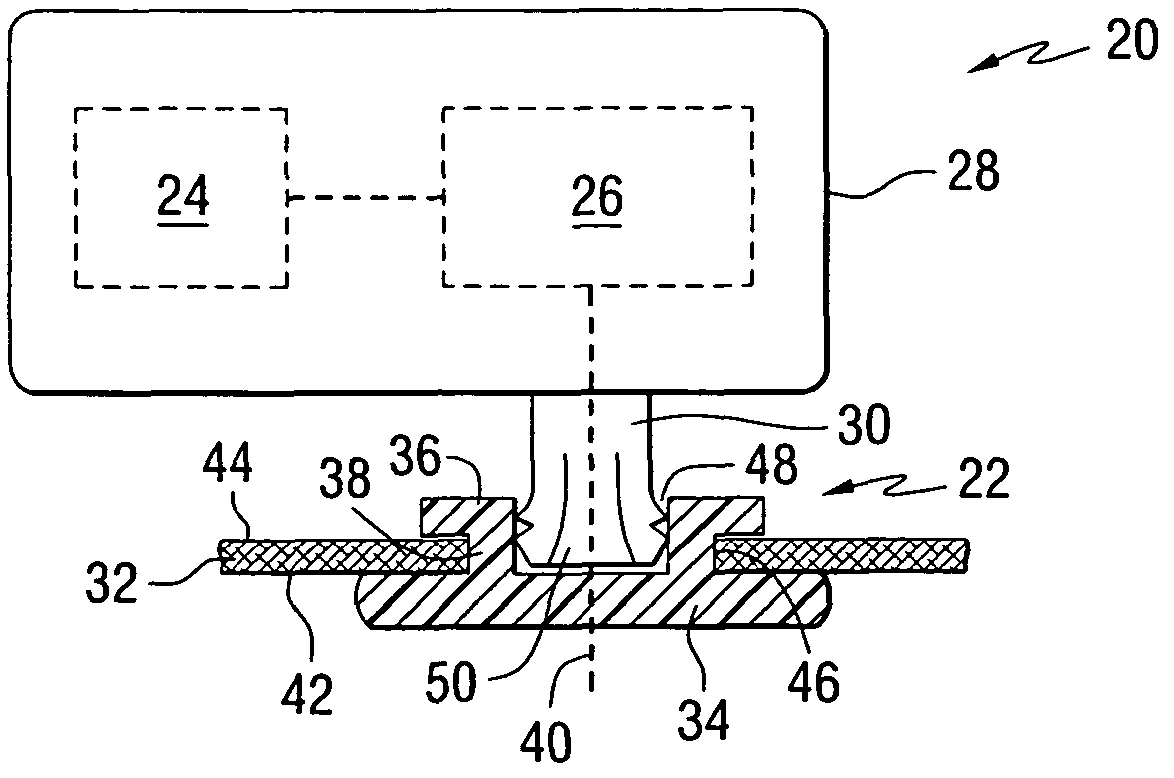 Bone conduction hearing aid fastening device