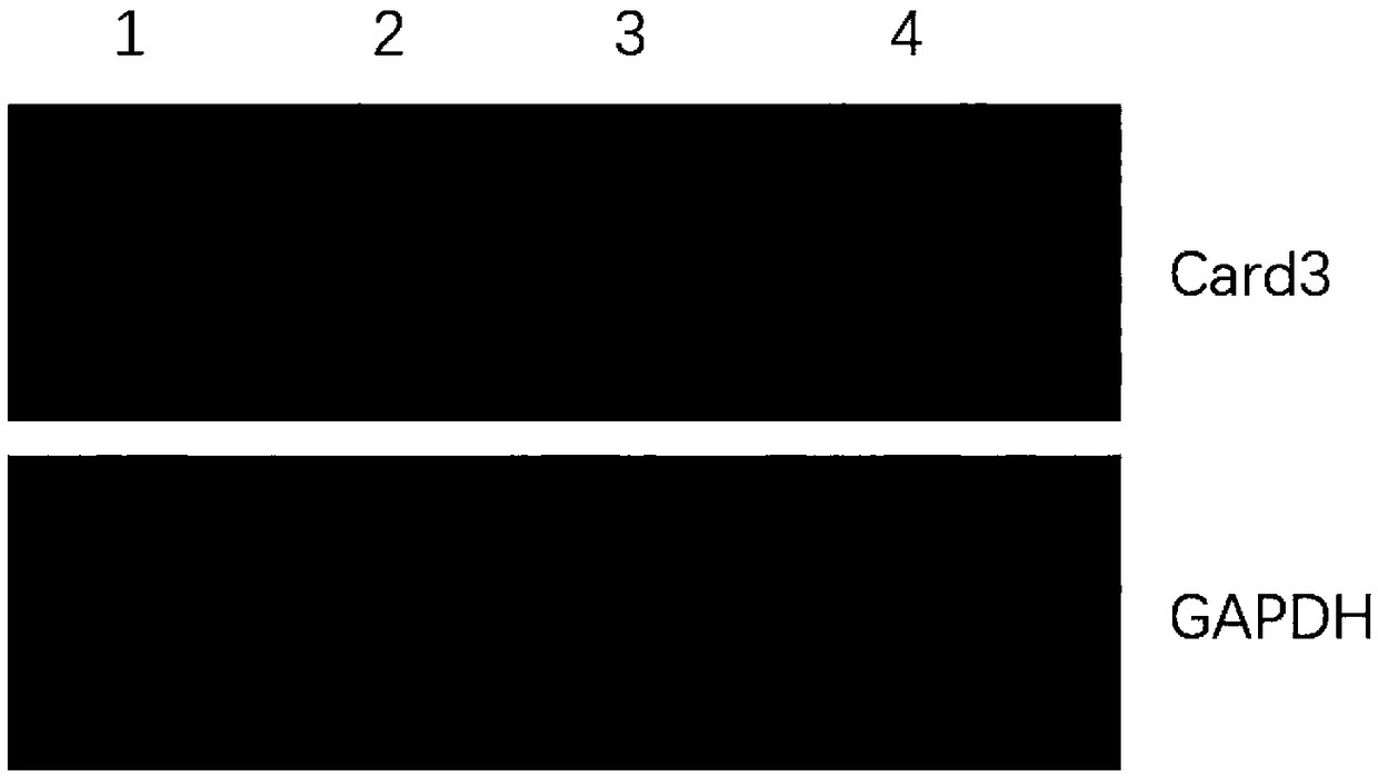 Method for knocking out Card3 gene of epidermal stem cell through CRISPR-Cas system