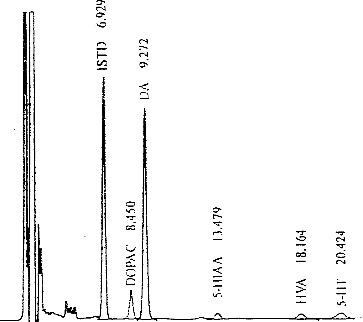 Medicine for treating parkinson's disease and Parkinson's syndrome and its prepn