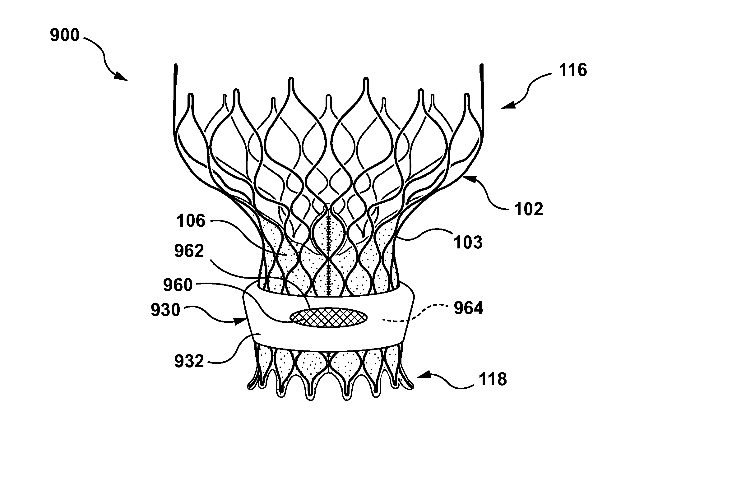 Transcatheter valve prostheses having a sealing component formed from tissue having an altered extracellular matrix