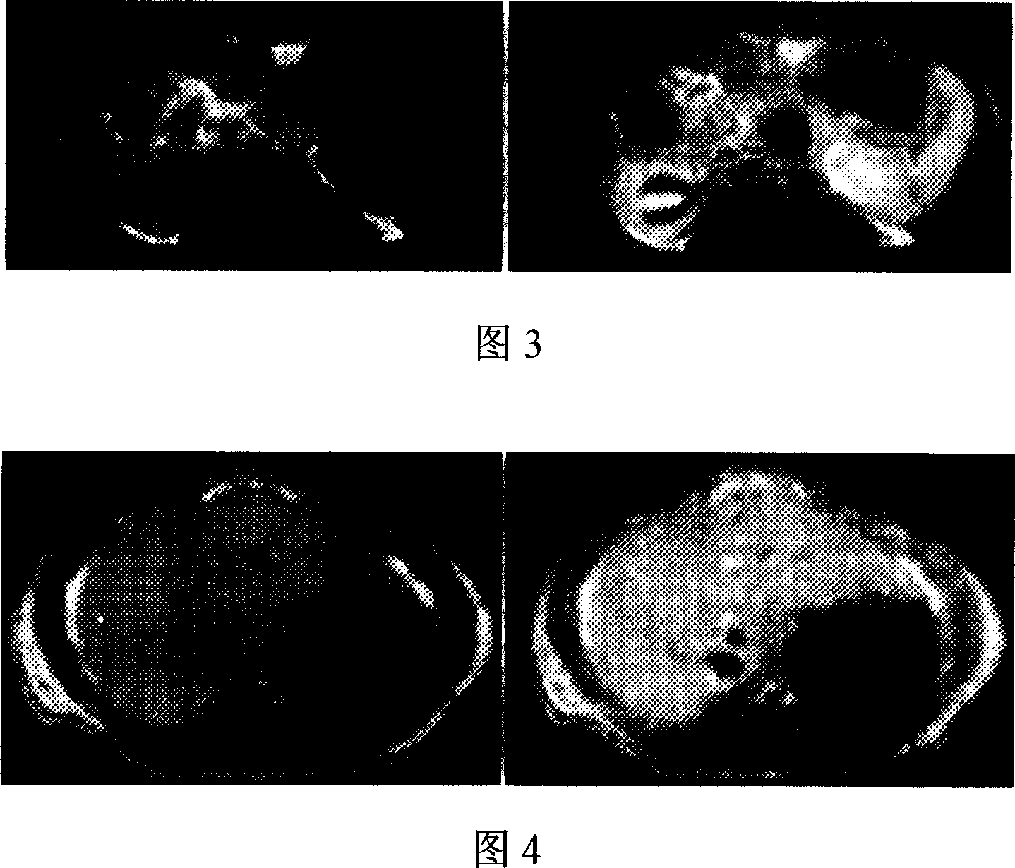 Magnetic resonace imaging contrast medium with glycyrrhizic acid as carrier