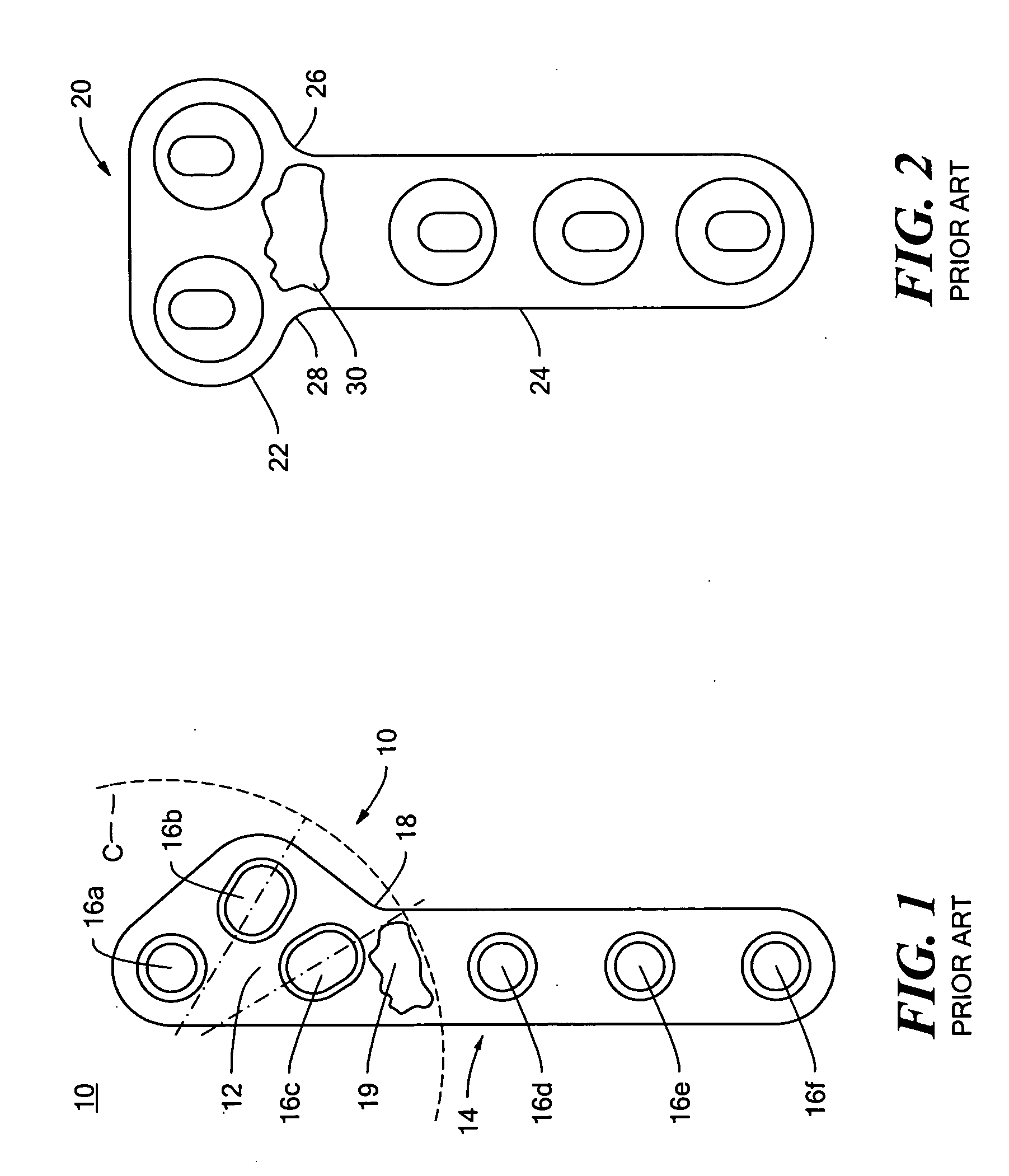 Fixation plate