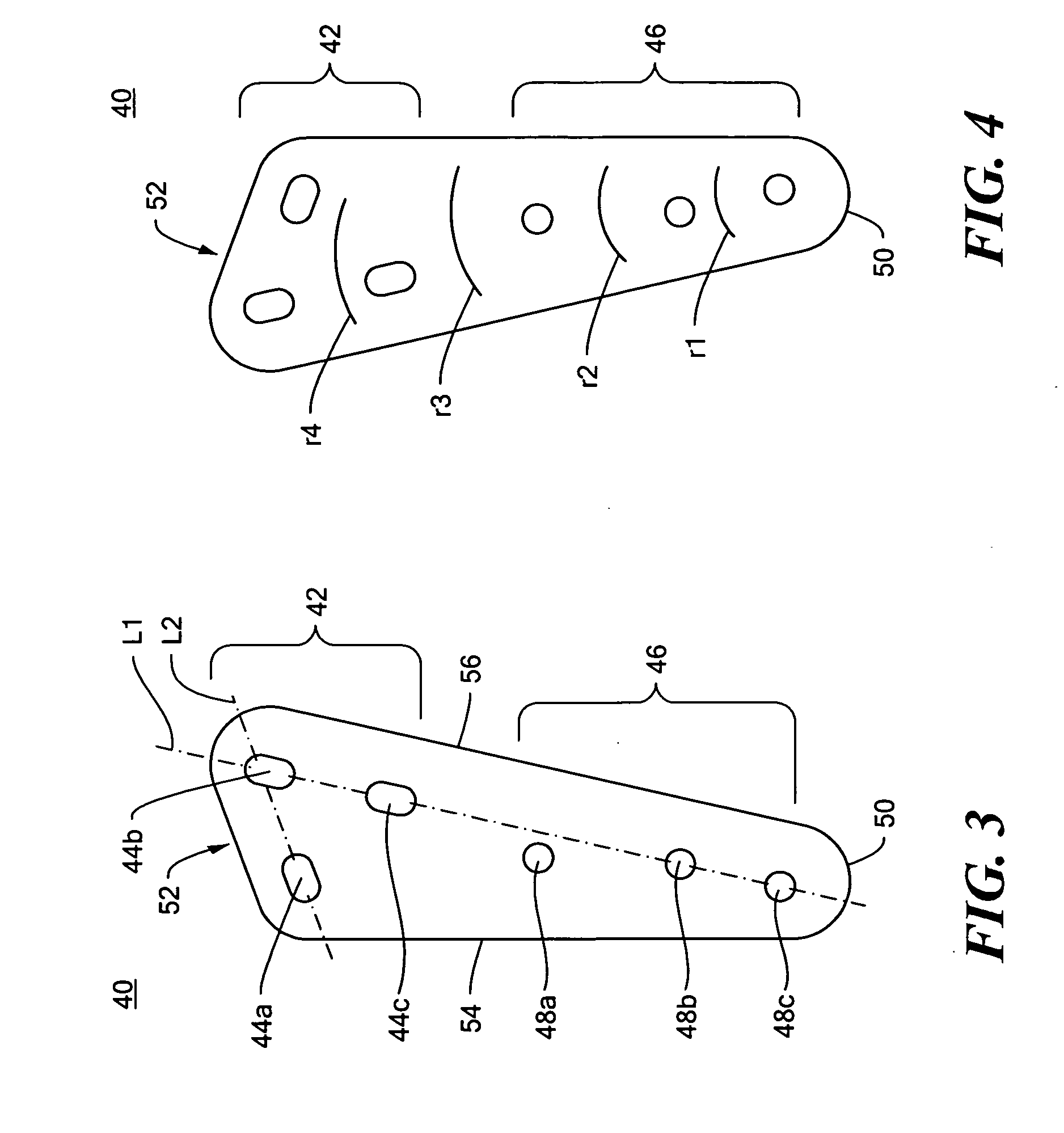 Fixation plate