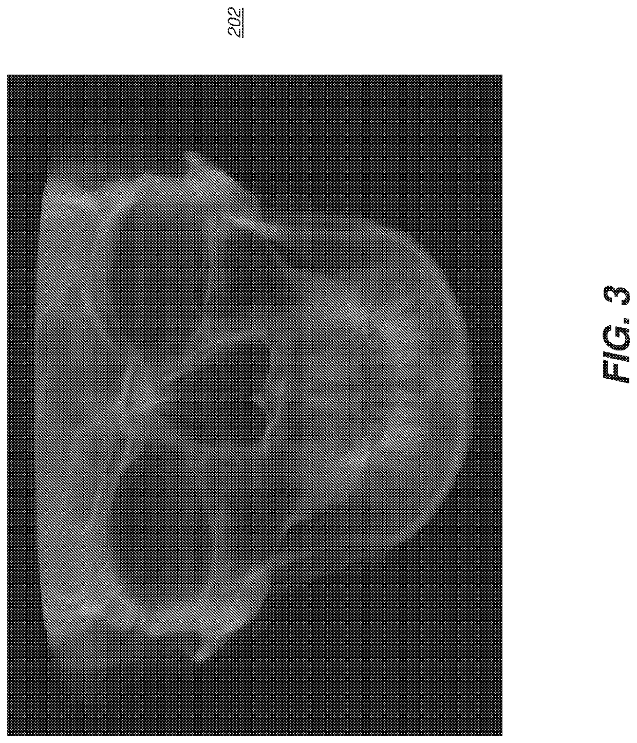 Method and System for 3D Cephalometric Analysis