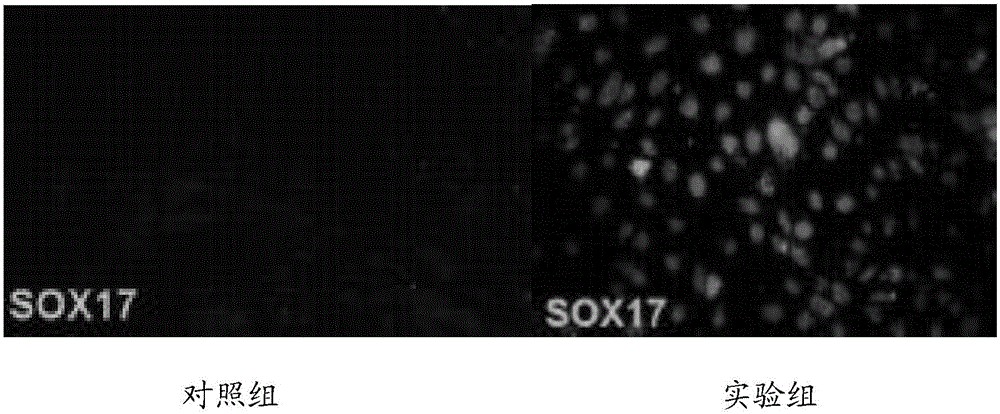 Serum-free induction medium and induction method for differentiating iPS (induced pluripotent stem) cell into endodermal progenitor cell