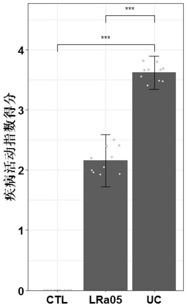 Application of lactobacillus rhamnosus in preparation of food or medicine for preventing and/or treating ulcerative colitis