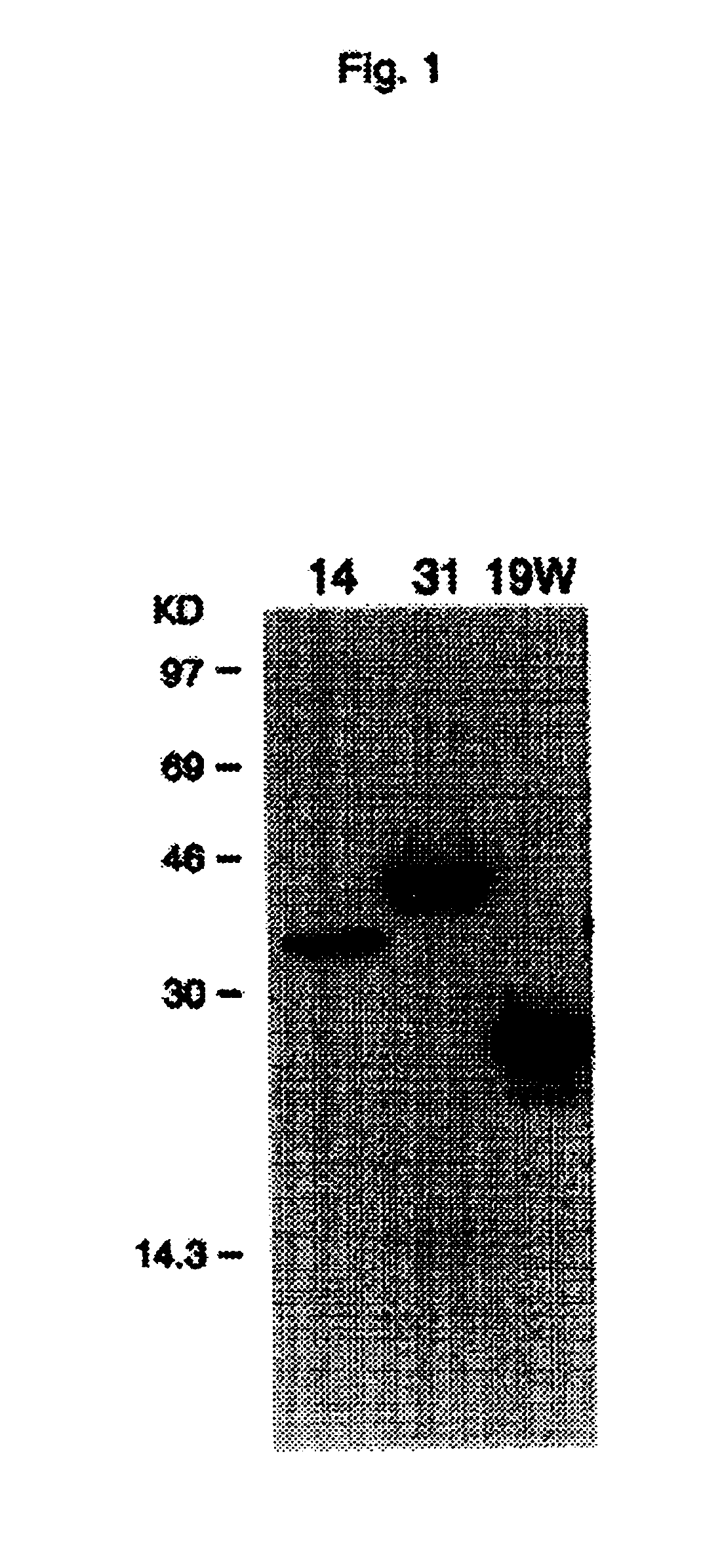 Antibodies to interleukin-1 receptor intracellular ligand proteins