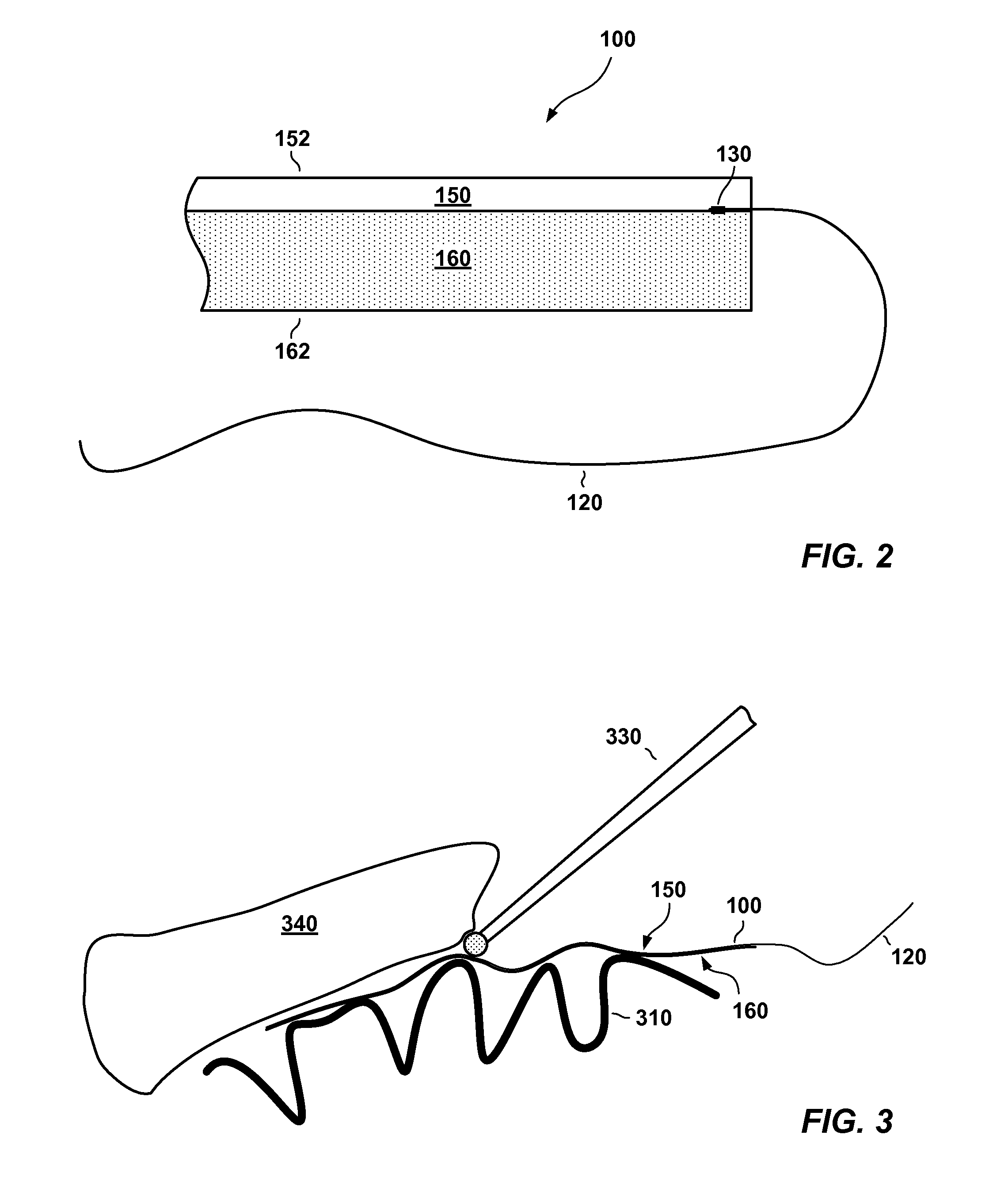 Multilayer Medical Sponge